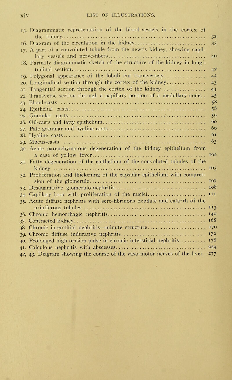 15. Diagrammatic representation of the blood-vessels in the cortex of the kidney 32 16. Diagram of the circulation in the kidney 33 17. A part of a convoluted tubule from the newt's kidney, showing capil- lary vessels and nerve-fibers 40 18. Partially diagrammatic sketch of the structure of the kidney in longi- tudinal section 42 19. Polygonal appearance of the lobuli cut transversely 42 20. Longitudinal section through the cortex of the kidney 43 21. Tangential section through the cortex of the kidney 44 22. Transverse section through a papillary portion of a medullary cone. . 45 23. Blood-casts 5$ 24. Epithelial casts 58 25. Granular casts 59 26. Oil-casts and fatty epithelium 60 27. Pale granular and hyaline casts 60 28. Hyaline casts 61 29. Mucus-casts 63 30. Acute parenchymatous degeneration of the kidney epithelium from a case of yellow fever 102 31. Fatty degeneration of the epithelium of the convoluted tubules of the kidney 103 32. Proliferation and thickening of the capsular epithelium with compres- sion of the glomerule 107 33. Desquamative glomerulo-nephritis 108 34. Capillary loop with proliferation of the nuclei 111 35. Acute diffuse nephritis with sero-fibrinous exudate and catarrh of the uriniferous tubules 113 36. Chronic hemorrhagic nephritis 14° 37. Contracted kidney 168 38. Chronic interstitial nephritis—minute structure 17° 39. Chronic diffuse indurative nephritis i72 40. Prolonged high tension pulse in chronic interstitial nephritis 178 41. Calculous nephritis with abscesses 229 42. 43. Diagram showing the course of the vaso-motor nerves of the liver. 277