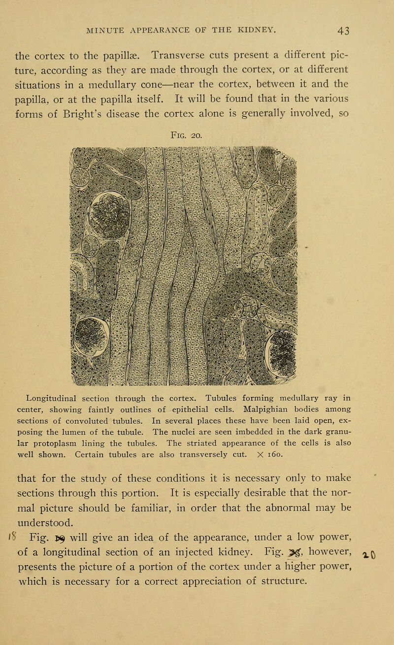 the cortex to the papillee. Transverse cuts present a different pic- ture, according as they are made through the cortex, or at different situations in a medullary cone—near the cortex, between it and the papilla, or at the papilla itself. It will be found that in the various forms of Bright's disease the cortex alone is generally involved, so Fig. 20. Longitudinal section through the cortex. Tubules forming medullary ray in center, showing faintly outlines of epithelial cells. Malpighian bodies among sections of convoluted tubules. In several places these have been laid open, ex- posing the lumen of the tubule. The nuclei are seen imbedded in the dark granu- lar protoplasm lining the tubules. The striated appearance of the cells is also well shown. Certain tubules are also transversely cut. X 160. that for the study of these conditions it is necessary only to make sections through this portion. It is especially desirable that the nor- mal picture should be familiar, in order that the abnormal may be understood. l8 Fig. 59 will give an idea of the appearance, under a low power, of a longitudinal section of an injected kidney. Fig. ?g, however, presents the picture of a portion of the cortex under a higher power, which is necessary for a correct appreciation of structure.