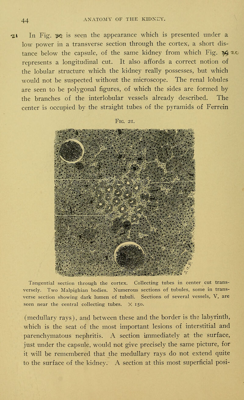 ♦z» In Fig'. 9Q is seen the appearance which is presented under a low power in a transverse section through the cortex, a short dis- tance below the capsule, of the same kidney from which Fig. ^ 2.0 represents a longitudinal cut. It also affords a correct notion of the lobular structure which the kidney really possesses, but which would not be suspected without the microscope. The renal lobules are seen to be polygonal figures, of which the sides are formed by the branches of the interlobular vessels already described. The center is occupied by the straight tubes of the pyramids of Ferrein Fig. 21. 1 - ... ■ - • -: ^^m^ --r.*.*h*- ~:?i'-v;'.'.^'. • •••. t'V **•„' ■ Tangential section through the cortex. Collecting tubes in center cut trans- versely. Two Malpighian bodies. Numerous sections of tubules, some in trans- verse section showing dark lumen of tubuli. Sections of several vessels, V, are seen near the central collecting tubes. X 150. (medullary rays), and between these and the border is the labyrinth, which is the seat of the most important lesions of interstitial and parenchymatous nephritis. A section immediately at the surface, just under the capsule, would not give precisely the same picture, for it will be remembered that the medullary rays do not extend quite to the surface of the kidney. A section at this most superficial posi-