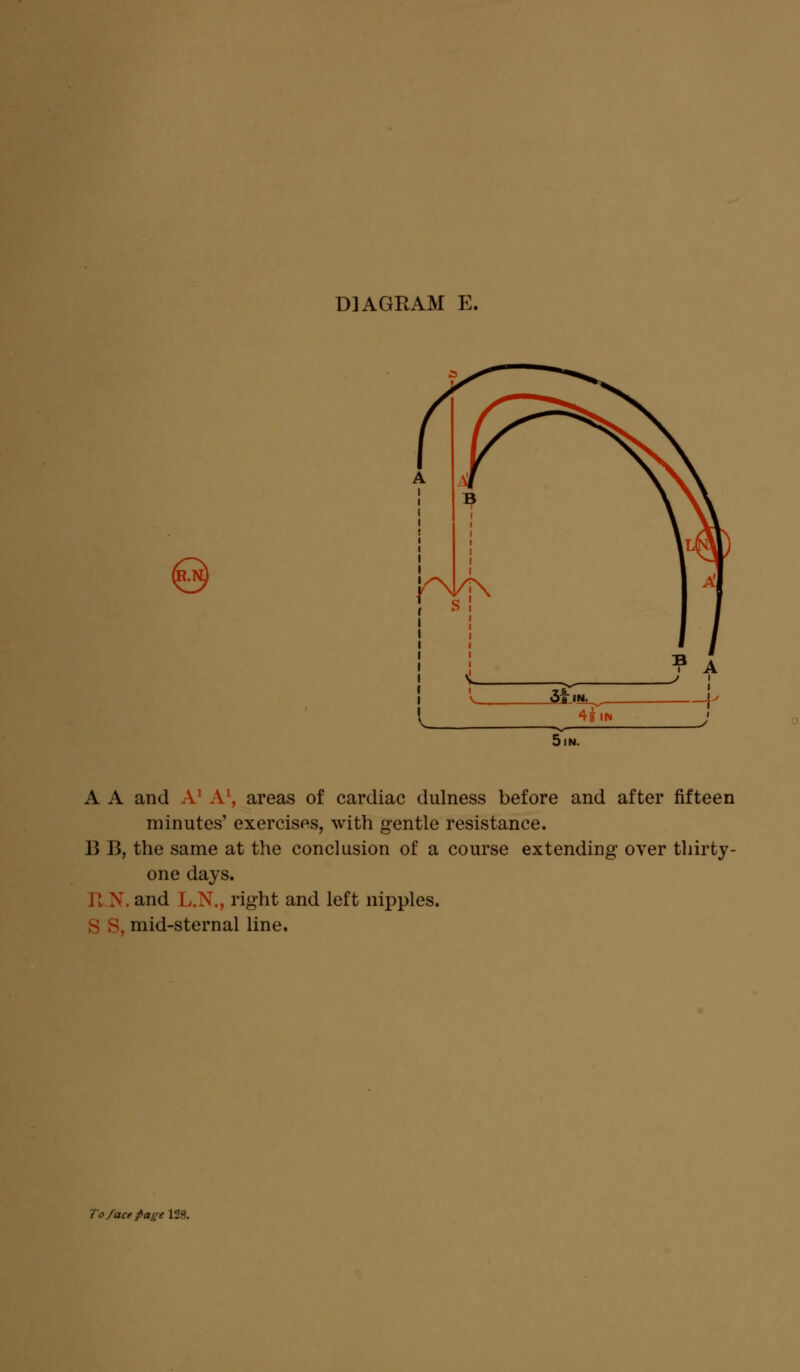 © A A and A1 A1, areas of cardiac dulness before and after fifteen minutes' exercises, with gentle resistance. 1] B, the same at the conclusion of a course extending over thirty- one days. R.N. and L.N., right and left nipples. S S, mid-sternal line. To/aaPageY&.