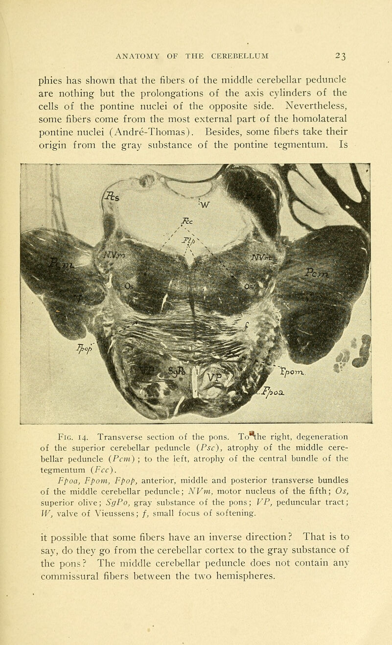 phies has shown that the fibers of the middle cerebellar peduncle are nothing but the prolongations of the axis cylinders of the cells of the pontine nuclei of the opposite side. Nevertheless, some fibers come from the most external part of the homolateral pontine nuclei (Andre-Thomas). Besides, some fibers take their origin from the gray substance of the pontine tegmentum. Is Fig. 14. Transverse section of the pons. To^he right, degeneration of the superior cerebellar peduncle (Psc), atrophy of the middle cere- bellar peduncle (Pern) ; to the left, atrophy of the central bundle of the tegmentum (Fee). Fpoa, Fpom, Fpop, anterior, middle and posterior transverse bundles of the middle cerebellar peduncle; NVm, motor nucleus of the fifth; Os, superior olive; SgPo, gray substance of the pons; VP, peduncular tract; W, valve of Vieussens; /, small focus of softening. it possible that some fibers have an inverse direction? That is to say, do they go from the cerebellar cortex to the gray substance of the pons? The middle cerebellar peduncle does not contain any commissural fibers between the two hemispheres.