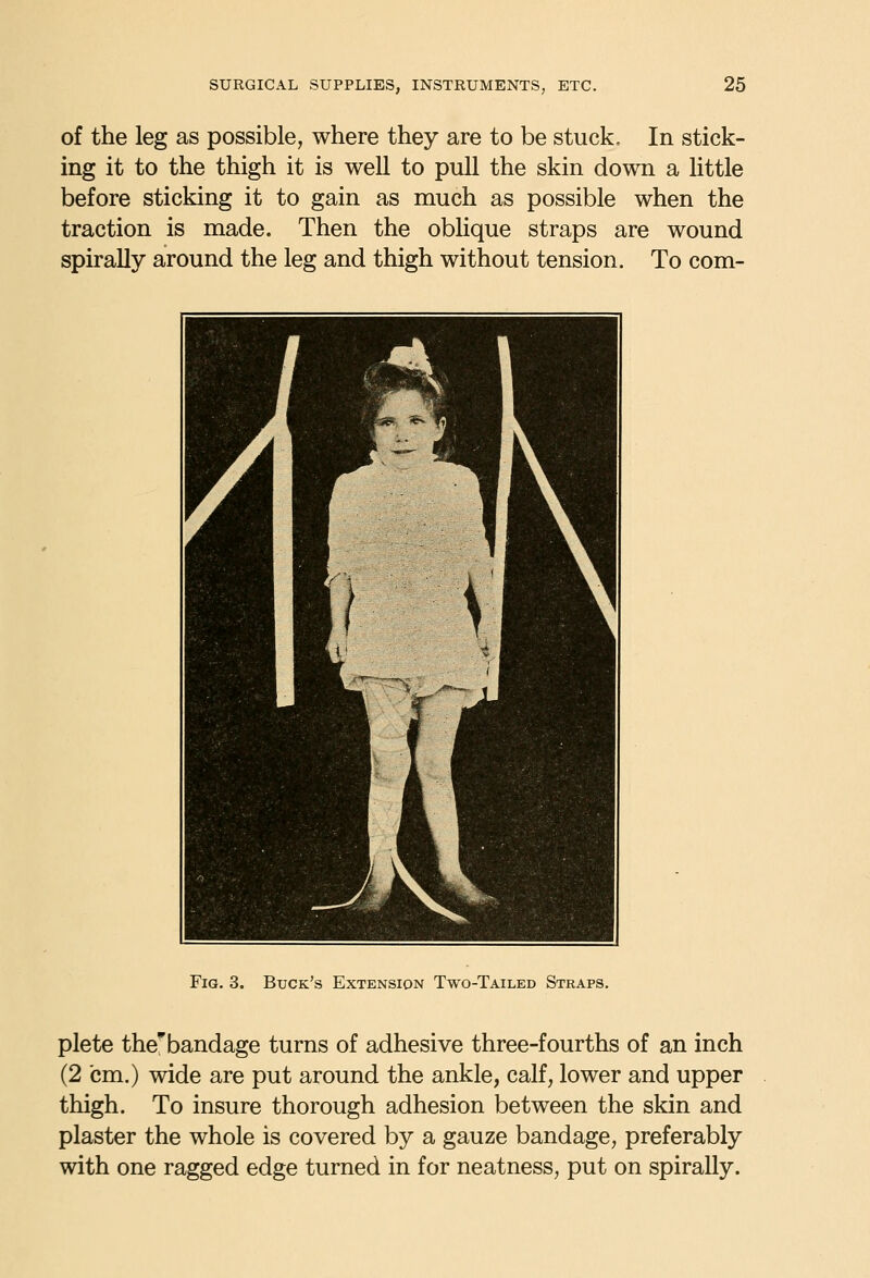 of the leg as possible, where they are to be stuck. In stick- ing it to the thigh it is well to pull the skin down a little before sticking it to gain as much as possible when the traction is made. Then the oblique straps are wound spirally around the leg and thigh without tension. To com- FiG. 3. Buck's Extension Two-Tailed Straps. plete the'bandage turns of adhesive three-fourths of an inch (2 cm.) wide are put around the ankle, calf, lower and upper thigh. To insure thorough adhesion between the skin and plaster the whole is covered by a gauze bandage, preferably with one ragged edge turned in for neatness, put on spirally.