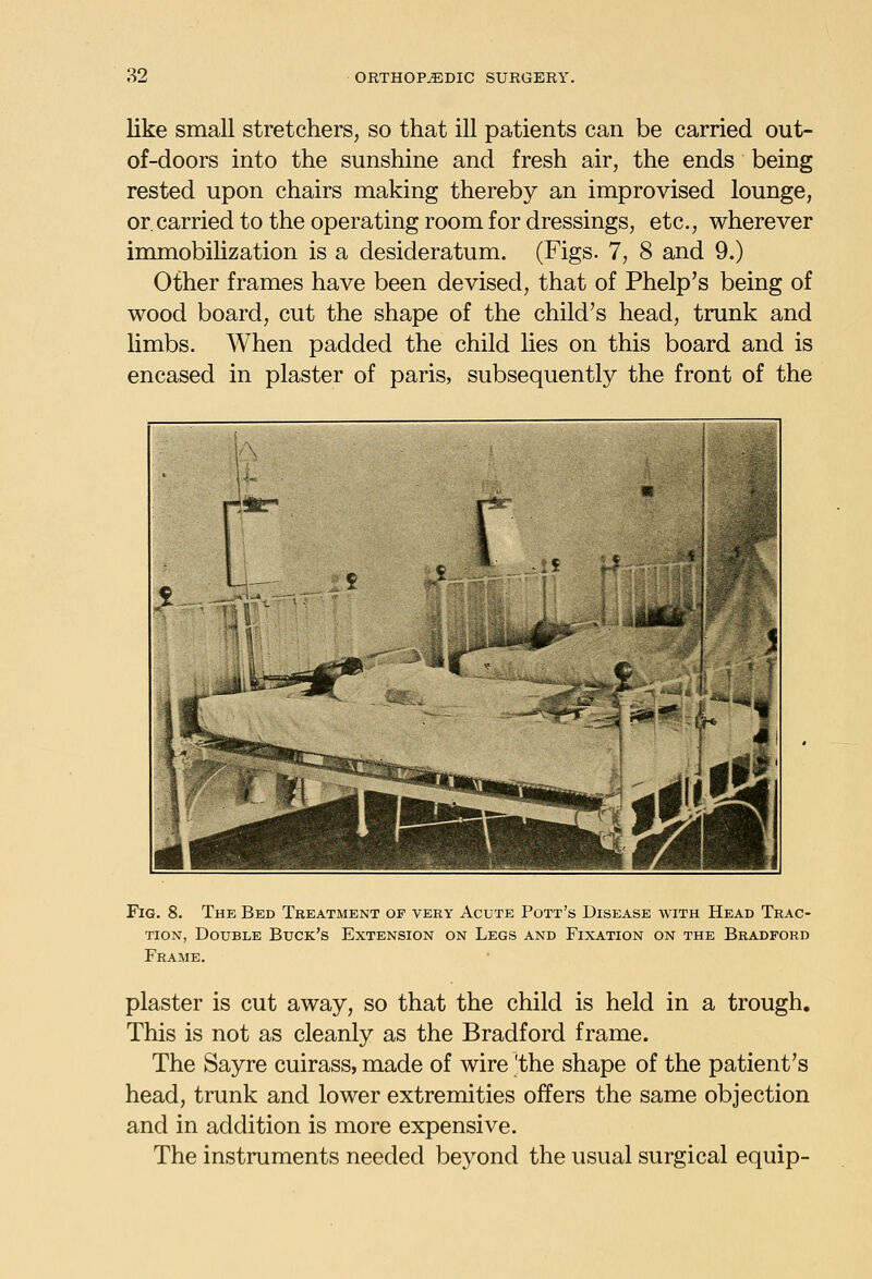 like small stretchers, so that ill patients can be carried out- of-doors into the sunshine and fresh air, the ends being rested upon chairs making thereby an improvised lounge, or carried to the operating room for dressings, etc., wherever immobiUzation is a desideratum. (Figs. 7, 8 and 9.) Other frames have been devised, that of Phelp's being of wood board, cut the shape of the child's head, trunk and Umbs. When padded the child lies on this board and is encased in plaster of paris, subsequently the front of the Fig. 8. The Bed Treatment of very Acute Pott's Disease with Head Trac- tion, Double Buck's Extension on Legs and Fixation on the Bradford Frame. plaster is cut away, so that the child is held in a trough. This is not as cleanly as the Bradford frame. The Sayre cuirass, made of wire 'the shape of the patient's head, trunk and lower extremities offers the same objection and in addition is more expensive. The instruments needed beyond the usual surgical equip-