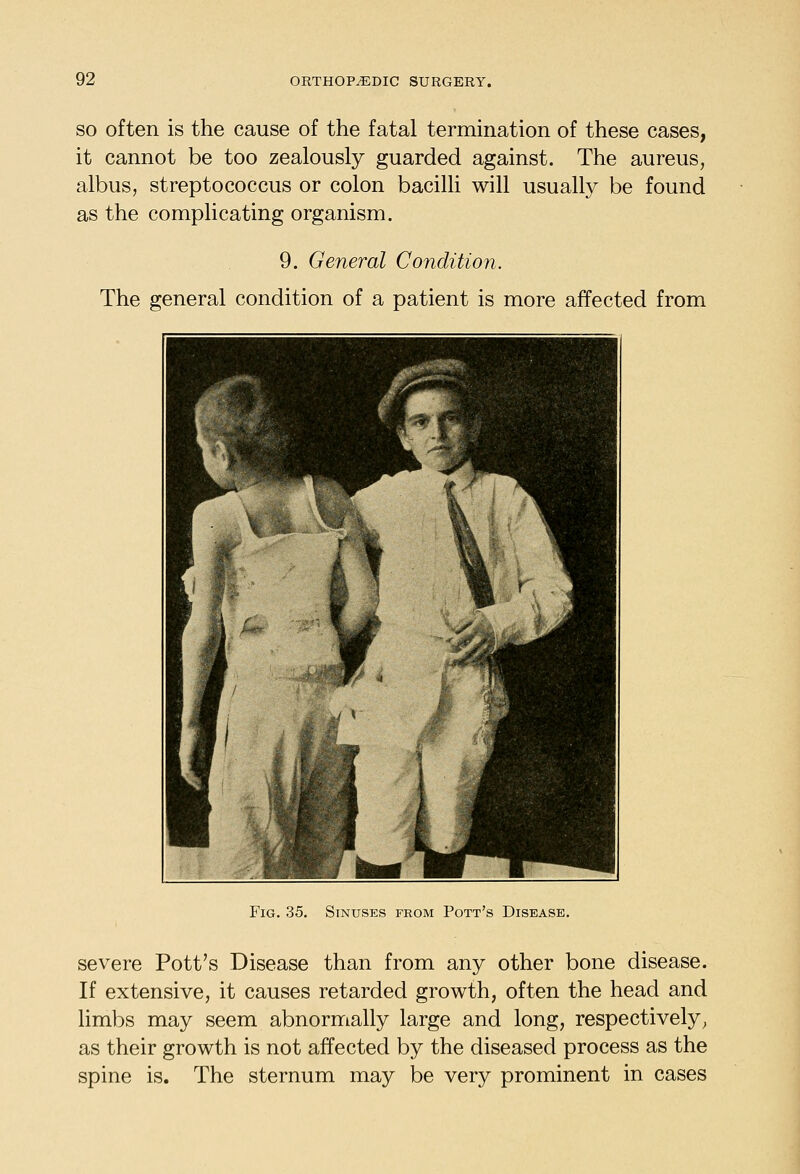 SO often is the cause of the fatal termination of these cases, it cannot be too zealously guarded against. The aureus, albus, streptococcus or colon bacilli will usually be found as the complicating organism. 9. General Condition. The general condition of a patient is more affected from Fig. 35. Sinuses from Pott's Disease. severe Pott's Disease than from any other bone disease. If extensive, it causes retarded growth, often the head and limbs may seem abnormally large and long, respectively, as their growth is not affected by the diseased process as the spine is. The sternum may be very prominent in cases