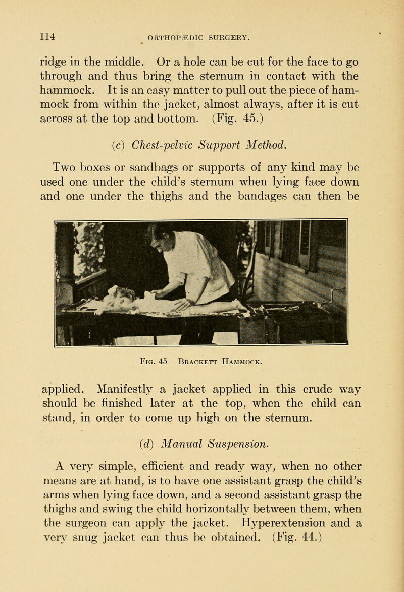 ridge in the middle. Or a hole can be cut for the face to go through and thus bring the sternum in contact with the hammock. It is an easy matter to pull out the piece of ham- mock from within the jacket, almost always, after it is cut across at the top and bottom. (Fig. 45.) (c) Chest-pelvic Support Method. Two boxes or sandbags or supports of any kind may be used one under the child's sternum when lying face down and one under the thighs and the bandages can then be Fig. 45 Brackett Hammock. applied. Manifestly a jacket applied in this crude way should be finished later at the top, when the child can stand, in order to come up high on the sternum. (d) Manual Suspension. A very simple, efficient and ready way, when no other means are at hand, is to have one assistant grasp the child's arms when lying face down, and a second assistant grasp the thighs and swing the child horizontally between them, when the surgeon can apply the jacket. Hyperextension and a very snug jacket can thus be obtained. (Fig. 44.)