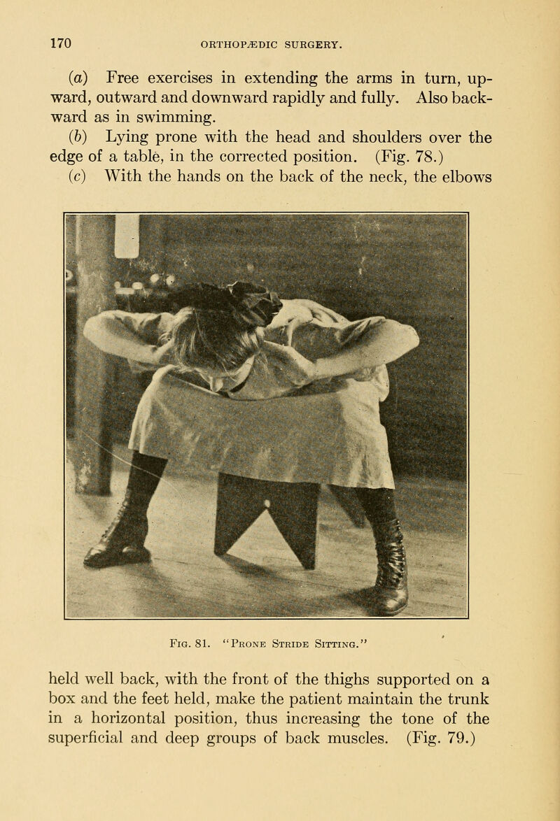 (a) Free exercises in extending the arms in turn, up- ward, outward and downward rapidly and fully. Also back- ward as in swimming. (b) Lying prone with the head and shoulders over the edge of a table, in the corrected position. (Fig. 78.) (c) With the hands on the back of the neck, the elbows Fig. 81. Prone Stride Sitting. held well back, with the front of the thighs supported on a box and the feet held, make the patient maintain the trunk in a horizontal position, thus increasing the tone of the superficial and deep groups of back muscles. (Fig. 79.)