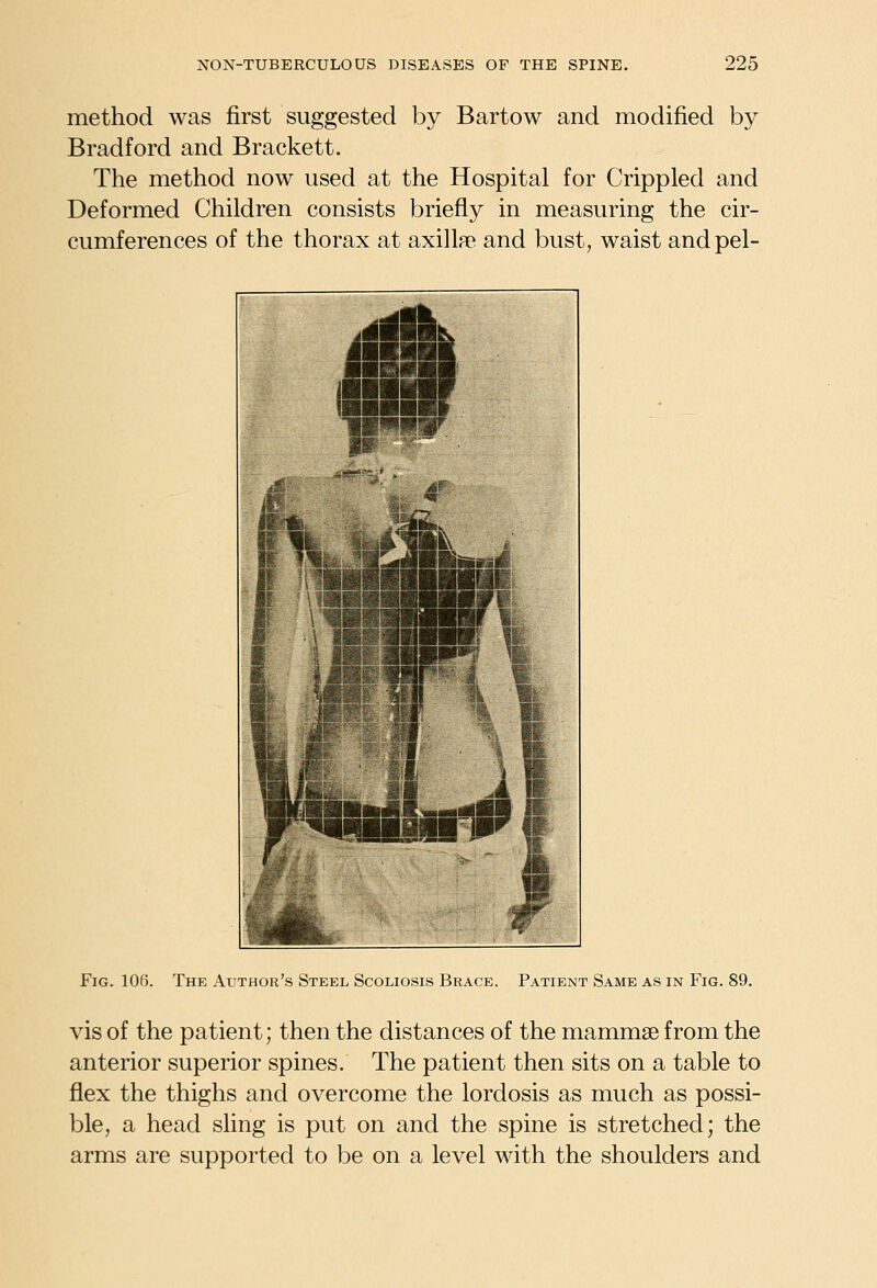 method was first suggested by Bartow and modified by Bradford and Brackett. The method now used at the Hospital for Crippled and Deformed Children consists briefly in measuring the cir- cumferences of the thorax at axillae and bust, waist and pel- FiG. 106. The Author's Steel Scoliosis Brace. Patient Same as in Fig. 89. vis of the patient; then the distances of the mammae from the anterior superior spines. The patient then sits on a table to flex the thighs and overcome the lordosis as much as possi- ble, a head sling is put on and the spine is stretched; the arms are supported to be on a level with the shoulders and