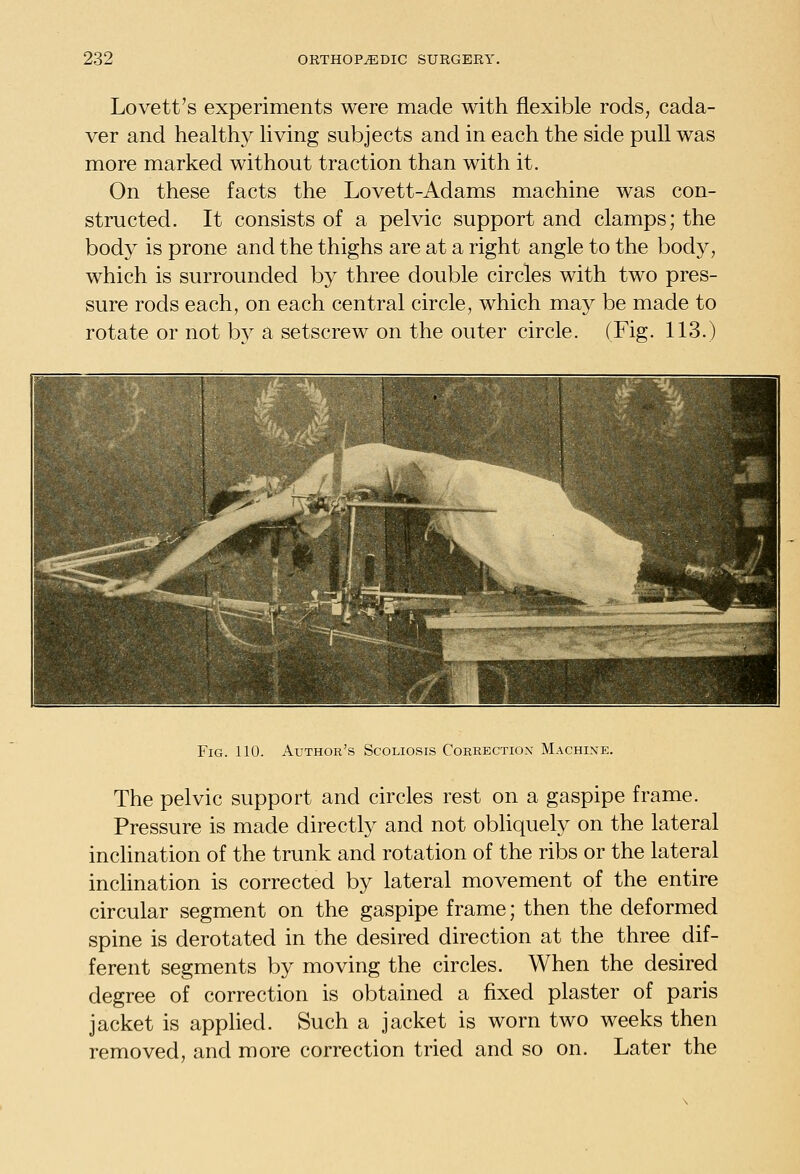 Lovett's experiments were made with flexible rods, cada- ver and healthy living subjects and in each the side pull was more marked without traction than with it. On these facts the Lovett-Adams machine was con- structed. It consists of a pelvic support and clamps; the body is prone and the thighs are at a right angle to the body, which is surrounded by three double circles with two pres- sure rods each, on each central circle, which may be made to rotate or not bv a setscrew on the outer circle. (Fig. 113.) Fig. 110. Author's Scoliosis Correction Machine. The pelvic support and circles rest on a gaspipe frame. Pressure is made directly and not obliquely on the lateral inclination of the trunk and rotation of the ribs or the lateral incHnation is corrected by lateral movement of the entire circular segment on the gaspipe frame; then the deformed spine is derotated in the desired direction at the three dif- ferent segments by moving the circles. When the desired degree of correction is obtained a fixed plaster of paris jacket is applied. Such a jacket is worn two weeks then removed, and more correction tried and so on. Later the