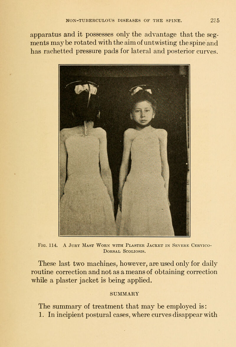 apparatus and it possesses only the advantage that the seg- ments may be rotated with the aim of untwisting the spine and has rachetted pressure pads for lateral and posterior curves. Fig. 114. A Jury Mast Worn with Plaster Jacket in Severe Cervico- DoRSAL Scoliosis. These last two machines, however, are used only for daily routine correction and not as a means of obtaining correction while a plaster jacket is being applied. SUMMARY The summary of treatment that may be employed is: 1. In incipient postural cases, where curves disappear with