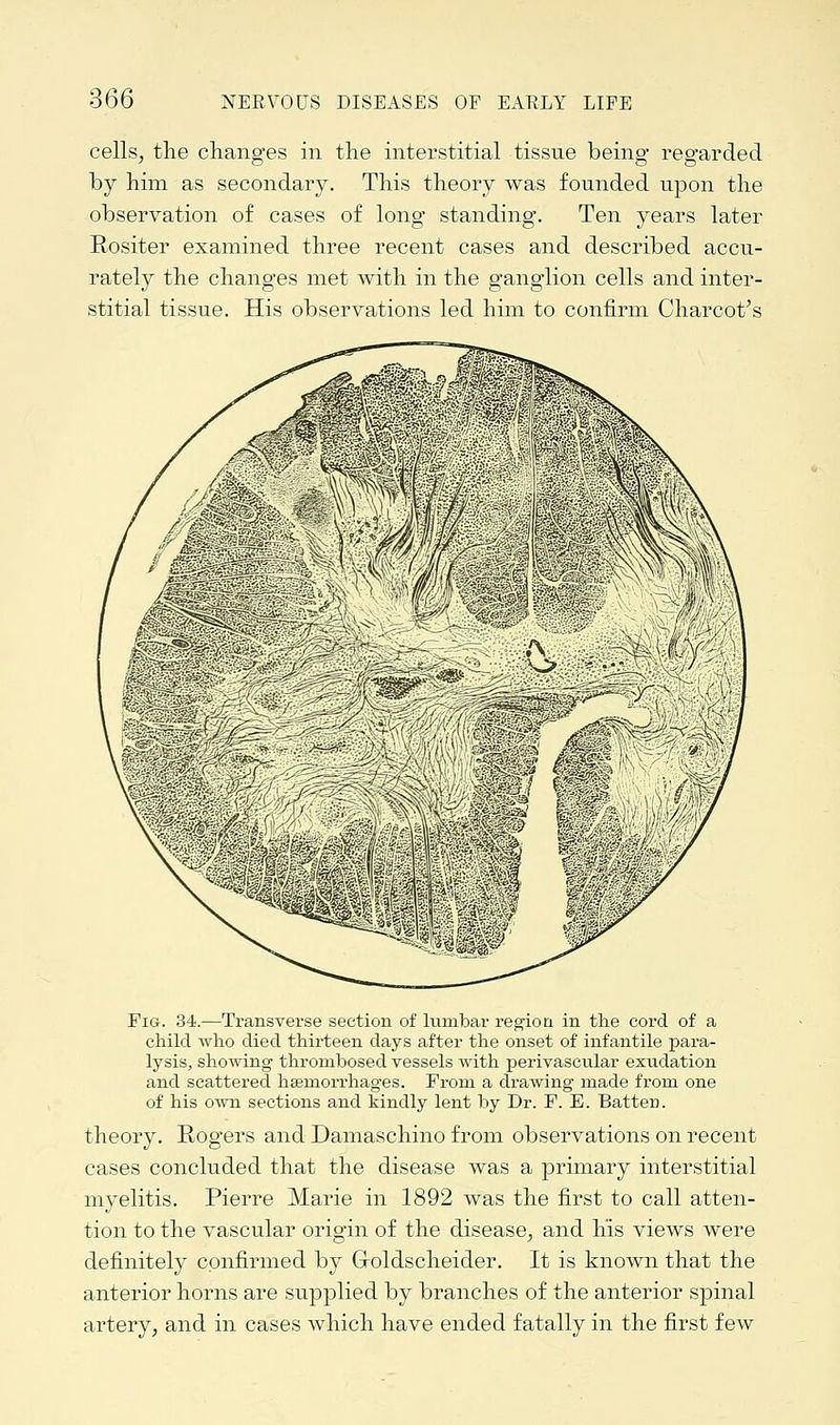 cells, the changes in the interstitial tissue being regarded by him as secondary. This theory was founded upon the observation of cases of long standing. Ten years later Rositer examined three recent cases and described accu- rately the changes met with in the ganglion cells and inter- stitial tissue. His observations led him to confirm Charcot's Fig. 34.—Transverse section of lumbar region in the cord of a child who died thirteen days after the onset of infantile para- lysis, showing thrombosed vessels with perivascular exudation and scattered heernorrhages. From a drawing made from one of his own sections and kindly lent by Dr. F. E. Batten. theory. Rogers and Damaschino from observations on recent cases concluded that the disease was a primary interstitial myelitis. Pierre Marie in 1892 was the first to call atten- tion to the vascular origin of the disease, and his views were definitely confirmed by Groldscheider. It is known that the anterior horns are supplied by branches of the anterior spinal artery, and in cases which have ended fatally in the first few