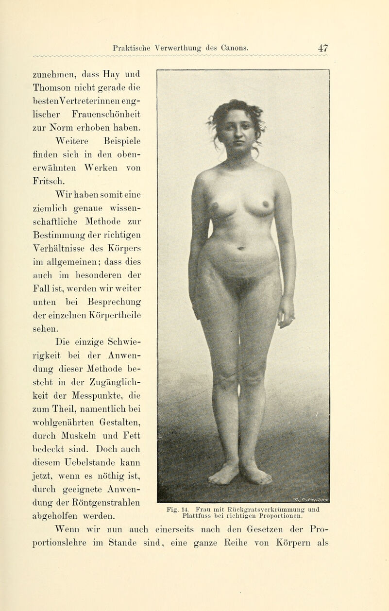 zunehmen, dass Hay und Thomson nicht gerade die bestenVertreterinuen eng- lischer Frauenschönheit zur Norm erhoben haben. Weitere Beispiele finden sich in den oben- erwähnten Werken von Fritsch. Wir haben somit eine ziemlich genaue wissen- schaftliche Methode zur Bestimmung der richtigen Verhältnisse des Körpers im allgemeinen; dass dies auch im besonderen der Fall ist, werden wir weiter unten bei Besprechung der einzelnen Körpertheile sehen. Die einzige Schwie- rigkeit bei der Anwen- dung dieser Methode be- steht in der Zugänglich- keit der Messpunkte, die zum Theil, namentlich bei wohlgenährten Gestalten, durch Muskeln und Fett bedeckt sind. Doch auch diesem Uebelstande kann jetzt, wenn es nöthig ist, durch geeignete Anwen- dung der Röntgenstrahlen abgeholfen werden. Wenn wir nun auch einerseits nach den Gesetzen der Pro- portionslehre im Stande sind, eine ganze Reihe von Körpern als 14. Frau mit Rückgratsverkrümmimg Plattfuss bei richtigen Proportionen.