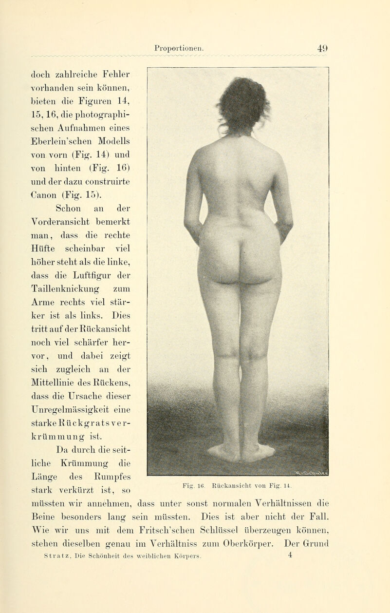 dock zahlreiche Fehler vorhanden sein können, bieten die Figuren 14, 15, 16, die photographi- schen Aufnahmen eines Eberlein'schen Modells von vorn (Fig. 14) und von hinten (Fig. 16) und der dazu construirte Canon (Fig. 15). Schon an der Vorderansicht bemerkt man, dass die rechte Hüfte scheinbar viel höher steht als die linke, dass die Luftfigur der Taillenknickung zum Arme rechts viel stär- ker ist als links. Dies tritt auf der Rückansicht noch viel schärfer her- vor, und dabei zeigt sich zugleich an der Mittellinie des Rückens, dass die Ursache dieser Unregelmässigkeit eine starke Rü ck g r a t s v e r- krümmung ist. Da durch die seit- liche Krümmung die Länge des Rumpfes stark verkürzt ist, so Fig. 16. Eückansicht von Fig. 14. müssten wir annehmen, dass unter sonst normalen Verhältnissen die Beine besonders lang sein müssten. Dies ist aber nicht der Fall. Wie wir uns mit dem Fritsch'schen Schlüssel überzeugen können, stehen dieselben genau im Verhältniss zum Oberkörper. Der Grund Stratz, Die Scliöulieit des weibliclien Körpers. 4