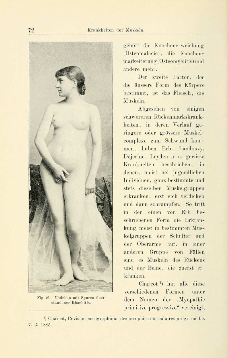 gehört die Knochenerweiclimig (Osteomalacie). die Knochen- mark eiterung (Osteomyelitis) und andere mehr. Der zweite Factor, der die äussere Form des Körpers bestimmt, ist das Fleisch, die Muskeln. Abgesehen von einigen schwereren Rückenmarkskrank- heiten, in deren Verlauf ge- ringere oder grössere Muskel- complexe zum Schwund kom- men , haben Erb, Landouzy, Dejerine, Leyden u. a. gewisse Krankheiten beschrieben, in denen, meist bei jugendlichen Individuen, ganz bestimmte und stets dieselben Muskelgruppen erkranken, erst sich verdicken und dann schrumpfen. So tritt in der einen von Erb be- schriebenen Form die Erkran- kung meist in bestimmten Mus- kelgruppen der Schulter und der Oberarme auf, in einer anderen Grruppe von Fällen sind es Muskeln des Rückens und der Beine, die zuerst er- kranken. Charcot ^) hat alle diese verschiedenen Formen unter dem Namen der , Myopathie primitive progressive vereinigt, ^) Charcot, Revision nosographique des atrophies musculaires progr. medic. 1885. Fig. 25. Mildchen mit Spuren über- standener Rliachitis.