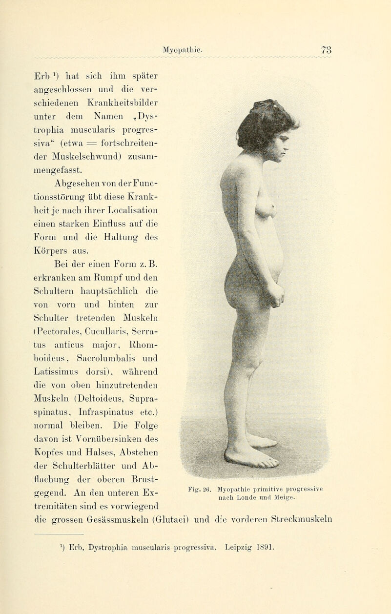 Erb ^) hat sicli ihm später angeschlossen und die ver- schiedenen Krankheitsbikler unter dem Namen „Dys- trophia muscularis progres- siva (etwa = fortschreiten- der Muskelschwund) zusam- mengefasst. Abgesehen von der Func- tionsstörung übt diese Krank- heit je nach ihrer Localisation einen starken Einfluss auf die Form und die Haltung des Körpers aus. Bei der einen Form z. B. erkranken am Rumjof und den Schultern hauptsächlich die von vorn und hinten zur Schulter tretenden Muskeln (Fectorales, CucuUaris, Serra- tus anticus major, Rhom- boideus, Sacrolumbalis und Latissimus dorsi), während die von oben hinzutretenden Muskeln (Deltoideus, Supra- spinatus, Infraspinatus etc.) normal bleiben. Die Folge davon ist Vornübersinken des Kopfes und Halses, Abstehen der Schulterblätter und Ab- flachung der oberen Brust- ~^'* gegend. An den unteren Ex- ^^^' ^^' tremitäten sind es vorwiegend die grossen Gesässmuskeln (Glutaei) und die vorderen Streckmuskeln Myoifatbie primitive progresbive nach Londe und Meige. Erb, Dystrophia muscularis progressiva. Leipzig 1891.