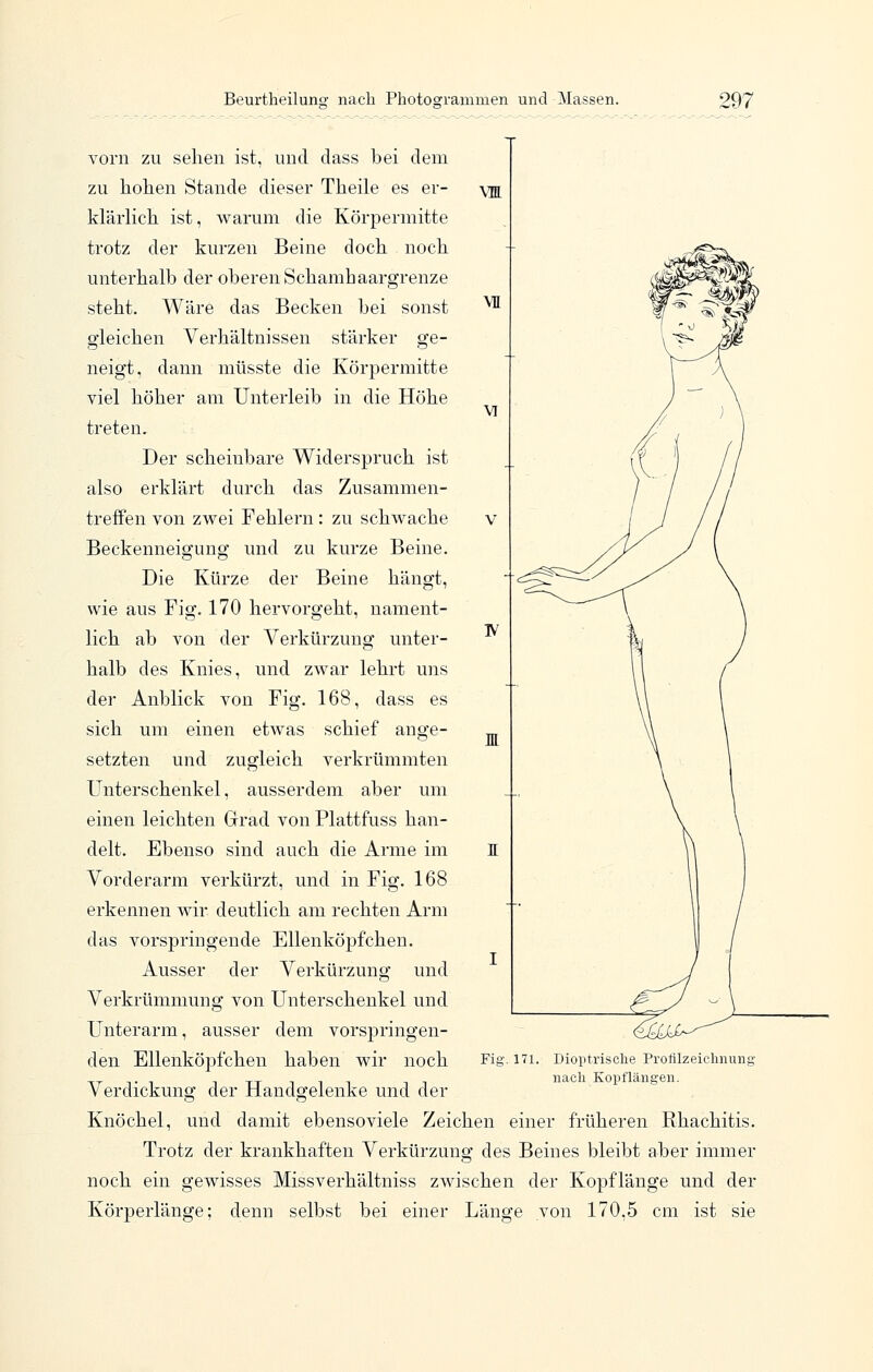 vorn zu sehen ist, und dass bei dem zu hohen Stande dieser Theile es er- klärlich ist, Avarum die Körpermitte trotz der kurzen Beine doch noch unterhalb der oberen Schamhaargrenze steht. Wäre das Becken bei sonst gleichen Verhältnissen stärker ge- neigt, dann müsste die Körpermitte viel höher am Unterleib in die Höhe treten. Der scheinbare Widerspruch ist also erklärt durch das Zusammen- treffen von zwei Fehlern : zu schwache Beckenneigung und zu kurze Beine. Die Kürze der Beine hängt, wie aus Fig. 170 hervorgeht, nament- lich ab von der Verkürzung unter- halb des Knies, und zwar lehrt uns der Anblick von Fig. 168, dass es sich um einen etwas schief ange- setzten und zugleich verkrümmten Unterschenkel, ausserdem aber um einen leichten Grad von Plattfuss han- delt. Ebenso sind auch die Arme im Vorderarm verkürzt, und in Fig. 168 erkennen wir deutlich am rechten Arm das vorspringende Ellenköpfchen. Ausser der Verkürzung und Verkrümmung von Unterschenkel und Unterarm, ausser dem vorspringen- den Ellenköpfchen haben wir noch Verdickung der Handgelenke und der Knöchel, und damit ebensoviele Zeichen einer früheren Rhachitis. Trotz der krankhaften Verkürzung des Beines bleibt aber immer noch ein gewisses Missverhältniss zwischen der Kopflänge und der Körperlänge; denn selbst bei einer Länge von 170,5 cm ist sie Fia-. 171. Dioptrisclie Profilzeiclinung iiaeli Kopflängen.