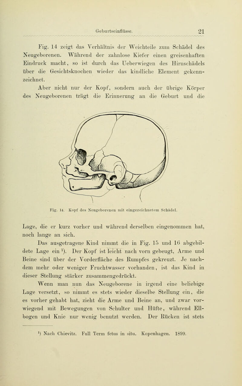 Fig. 14 zeigt das Verhältnis der Weichteile zum Schädel des Neugeborenen. Während der zahnlose Kiefer einen greisenhaften Eindruck macht, so ist durch das Ueberwiegen des Hirnschädels über die Gesichtsknochen wieder das kindliche Element gekenn- zeichnet. Aber nicht nur der Kopf, sondern auch der übrige Körper des Neugeborenen trägt die Erinneruno- an die Geburt und die Fig. 14. Kopf des Neugeborenen mit eingezeichnetem Schädel. Lage, die er kurz vorher und während derselben eingenommen hat, noch lange an sich. Das ausgetragene Kind nimmt die in Fig. 15 und 16 abgebil- dete Lage ein 1). Der Kopf ist leicht nach vorn gebeugt, Arme und Beine sind über der Vorderfiäche des Rumpfes gekreuzt. Je nach- dem mehr oder weniger Fruchtwasser vorhanden, ist das Kind in dieser Stellung stärker zusammengedrückt. Wenn man nun das Neugeborene in irgend eine beliebige Lage versetzt, so nimmt es stets wieder dieselbe Stellung ein, die es vorher gehabt hat, zieht die Arme und Beine an, und zwar vor- wiegend mit Bewegungen von Schulter und Hüfte, während Ell- bogen und Knie nur wenig benutzt werden. Der Rücken ist stets *) Nacli Chievitz. Füll Terra, fetus in situ. Kopenhagen. 1899.