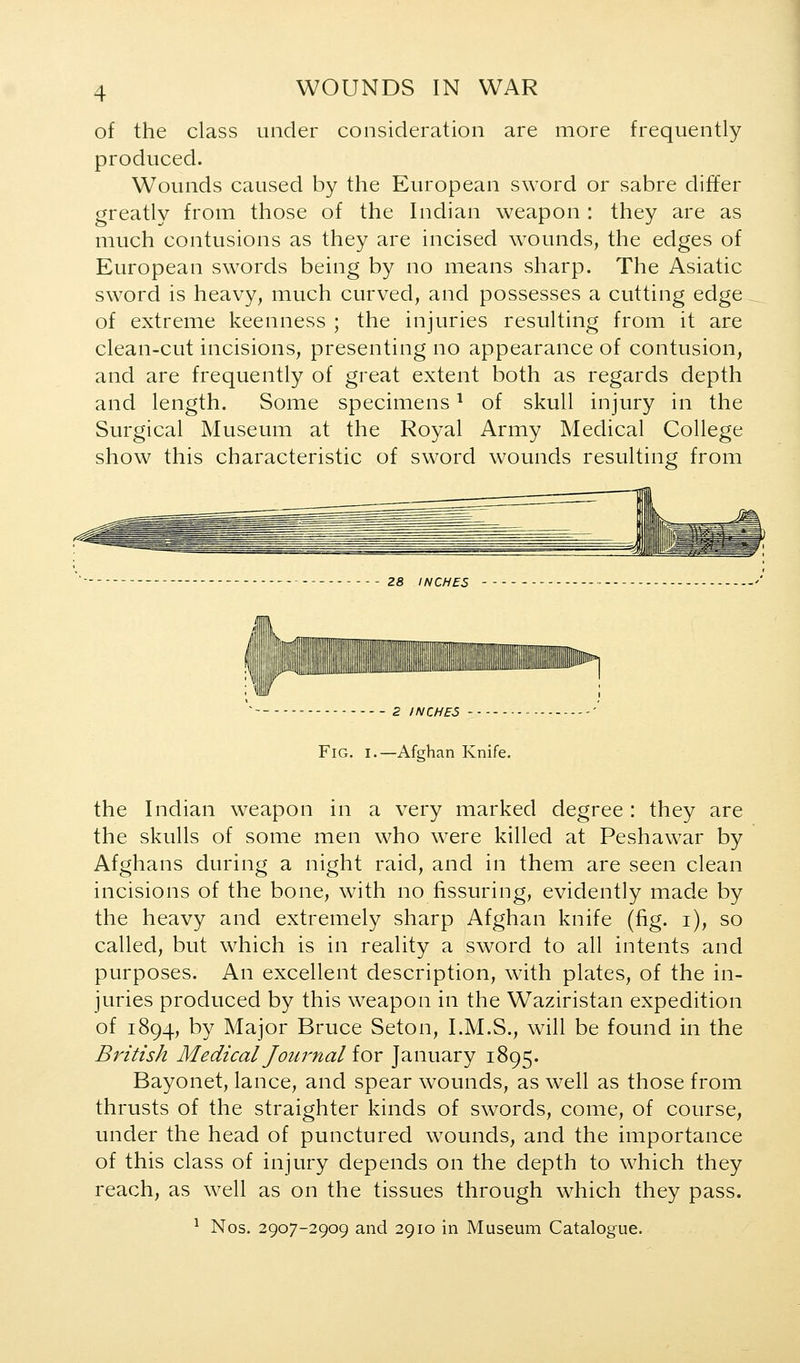 of the class under consideration are more frequently produced. Wounds caused by the European sword or sabre differ greatly from those of the Indian weapon : they are as much contusions as they are incised wounds, the edges of European swords being by no means sharp. The Asiatic sword is heavy, much curved, and possesses a cutting edge of extreme keenness ; the injuries resulting from it are clean-cut incisions, presenting no appearance of contusion, and are frequently of great extent both as regards depth and length. Some specimens ^ of skull injury in the Surgical Museum at the Royal Army Medical College show this characteristic of sword wounds resulting from 28 INCHES ■• ' 2 INCHES Fig. I.—Afghan Knife. the Indian weapon in a very marked degree : they are the skulls of some men who were killed at Peshawar by Afghans during a night raid, and in them are seen clean incisions of the bone, with no fissuring, evidently made by the heavy and extremely sharp Afghan knife (fig. i), so called, but which is in reality a sword to all intents and purposes. An excellent description, with plates, of the in- juries produced by this weapon in the Waziristan expedition of 1894, by Major Bruce Seton, I.M.S., will be found in the British Medical Journal iox January 1895. Bayonet, lance, and spear wounds, as well as those from thrusts of the straighter kinds of swords, come, of course, under the head of punctured wounds, and the importance of this class of injury depends on the depth to which they reach, as well as on the tissues through which they pass. ^ Nos. 2907-2909 and 2910 in Museum Catalogue.