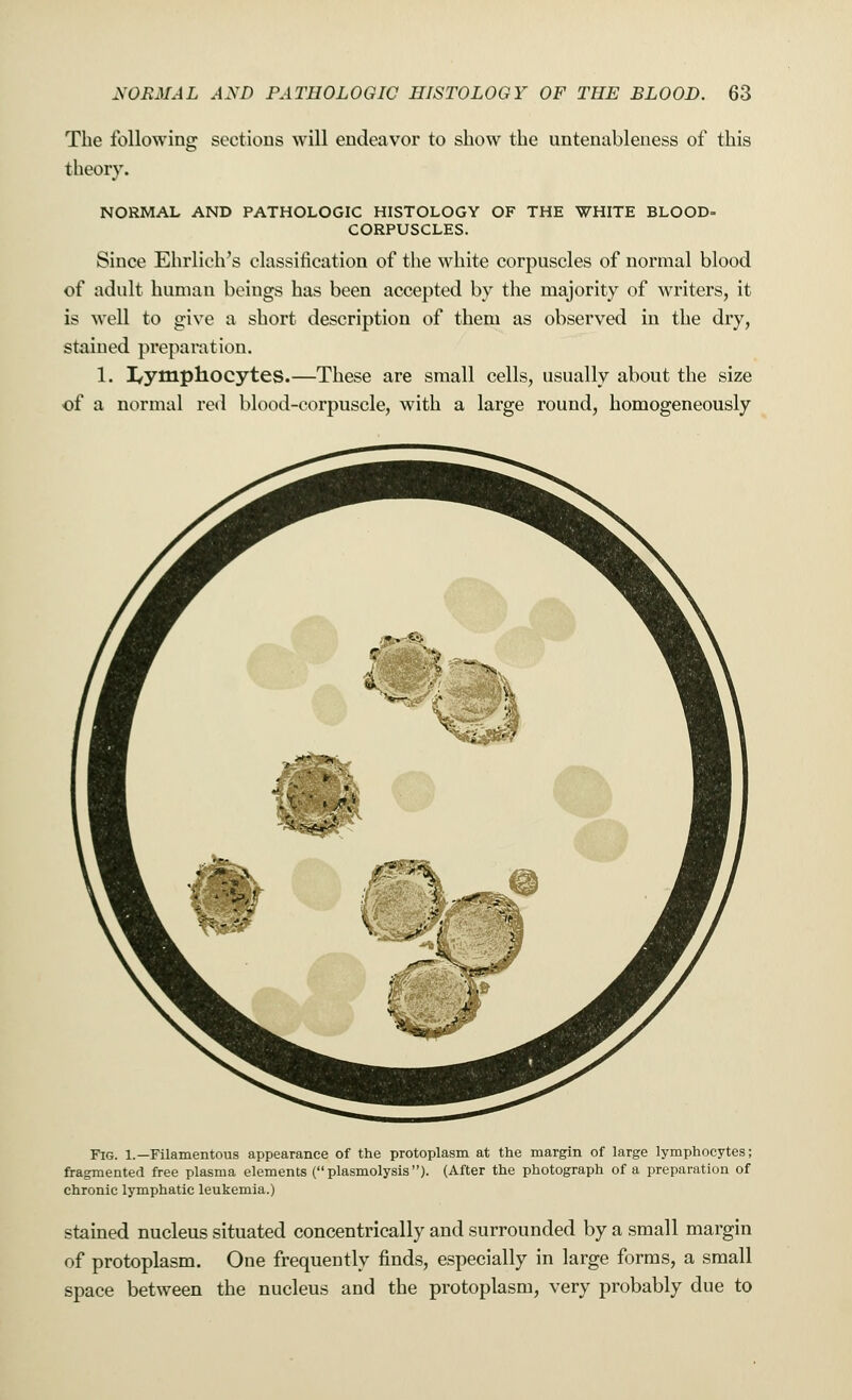 The following sections will endeavor to show the untenableness of this theory. NORMAL AND PATHOLOGIC HISTOLOGY OF THE WHITE BLOOD- CORPUSCLES. Since Ehrlich's classification of the white corpuscles of normal blood of adult human beings has been accepted by the majority of writers, it is well to give a short description of them as observed in the dry, stained preparation. 1. lymphocytes.—These are small cells, usually about the size of a normal red blood-corpuscle, with a large round, homogeneously Fig. 1.—Filamentous appearance of the protoplasm at the margin of large lymphocytes; fragmented free plasma elements (plasmolysis). (After the photograph of a preparation of chronic lymphatic leukemia.) stained nucleus situated concentrically and surrounded by a small margin of protoplasm. One frequently finds, especially in large forms, a small space between the nucleus and the protoplasm, very probably due to