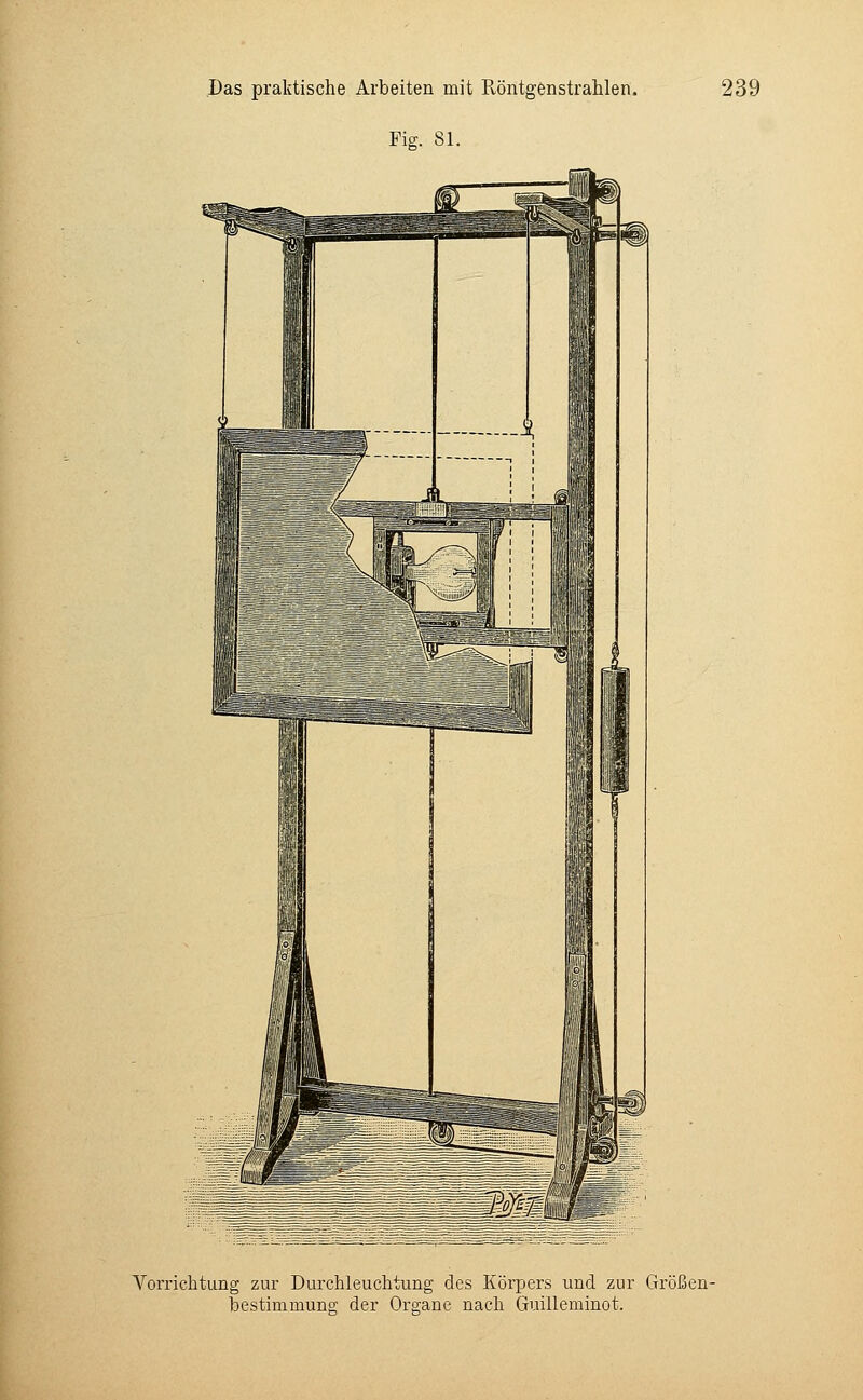 Fig. 81. Vorrichtung zur Durchleuchtung des Körpers und zur Größen- bestimmung der Organe nach Guilleminot.