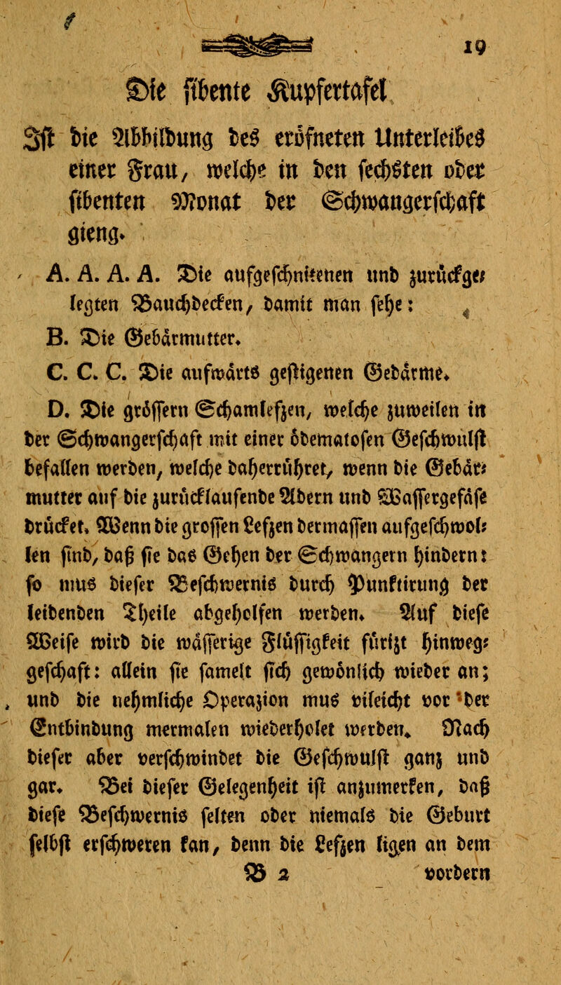 IQ t){e pente ^upfetwfel ^t ik 9iBb!lt)ung be5 eröfnete« UnterleiBeS einer Srau, welc|)e in fcen fei^öte« oitt mm* ' A. A. A. A. 3Me auf^efc^nieettctt iinb jurörfg« legten 93auc^t>e(fen/ t)amit man fe^c: ^ B. 5Die (Sebdrmutter* C. C C. 5E)tc aiifmdttö gcj^tgetten ©etdtm^* D. J)le gröflcrn ©c^amfefjen, tt)etc^e juweilett trt ter @c^tt)an9erfcf)aft mit einec 6t)ematofm ©cfcbtüiilfl befaßcn weröen, tüclc^e t^a^eccu^ret, n?enn bte ®cbati mwtter auf bic jurticf laufende 2tbern unb ^aflfctöefnfe brucfet, 5Benn \ixit gcoficn ßcfjen bcrmaflen aufgefi^tDoC? len finb/ ba^ fie baö @ef)en ber ©d)ttjanßetn I)inbernt fo mu6 btefer 92efd)tuerni6 burc^ ?)unftininö bet letbenben 5l)ei(e abgeholfen njerben» Sfitf biefe Qßeife ttJtfb bic njdfietigc glüjfißfeit fßdjt j^intwegj gefc^aft: attein jie famclt jic^ getDonlic^ uneber an; iinb btc nc^mlic^e Ov^erajton mu^ tJileic^t üor 'bct Snttinbung m^rmalen wieber^clet tDerben* O^ac^ biefec aber t)ctrf(^tt)inbet W ©efc^tüUlfl ganj unb gar* 55ei biefer ©elegen^cit ip anjnmetfen, X:^^^ btefe SSefc^tverniö \t\xm ober ntemalö bie ©ebuvt felbjt erf(^tpeten fan, benn bie üef^en %en an bem ^ Ä tjorbern