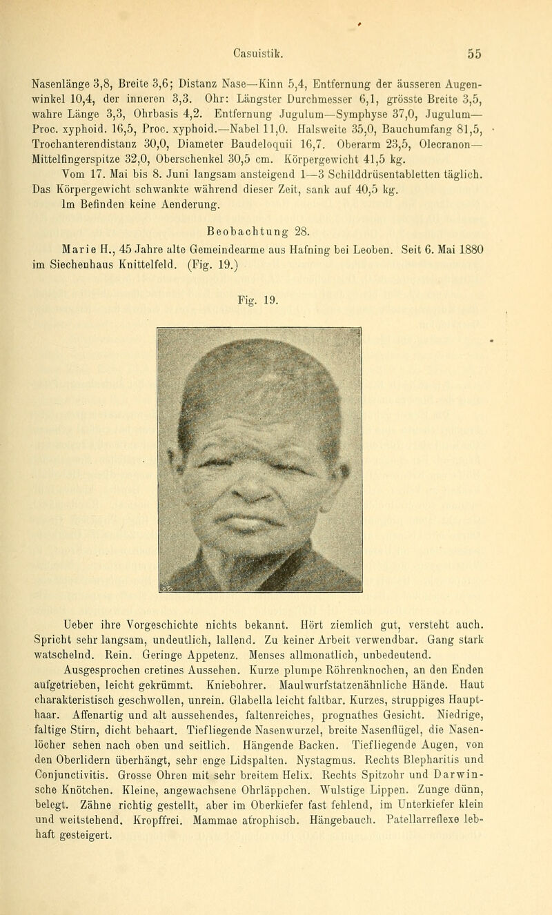 Nasenlänge 3,8, Breite 3,6; Distanz Nase—Kinn 5,4, Entfernung der äusseren Augen- winkel 10,4, der inneren 3,3. Ohr: Längster Durchmesser 6,1, grösste Breite 3,5, wahre Länge 3,3, Ohrbasis 4,2. Entfernung Jugulum—Symphyse 37,0, Jugulum— Proc. xyphoid. 16,5, Proc. xyphoid.—Nabel 11,0. Halsweite 35,0, Bauchumfang 81,5, Trochanterendistanz 30,0, Diameter Baudeloquii 16,7. Oberarm 23,5, Olecranon— Mittelfingerspitze 32,0, Oberschenkel 30,5 cm. Körpergewicht 41,5 kg. Vom 17. Mai bis 8. Juni langsam ansteigend 1—3 Schilddrüsentabletten täglich. Das Körpergewicht schwankte während dieser Zeit, sank auf 40,5 kg. Im Befinden keine Aenderung. Beobachtung 28. Marie H., 45 Jahre alte Gemeindearme aus Hafning bei Leoben. im Siechenhaus Knittelfeld. (Fig. 19.) Seit 6. Mai 1880 Fig;. 19. Ueber ihre Vorgeschichte nichts bekannt. Hört ziemlich gut, versteht auch. Spricht sehr langsam, undeutlich, lallend. Zu keiner Arbeit verwendbar. Gang stark watschelnd. Rein. Geringe Appetenz. Menses allmonatlich, unbedeutend. Ausgesprochen cretines Aussehen. Kurze plumpe Röhrenknochen, an den Enden aufgetrieben, leicht gekrümmt. Kniebohrer. Maulwurfstatzenähnliche Hände. Haut charakteristisch geschwollen, unrein. Glabella leicht faltbar. Kurzes, struppiges Haupt- haar. Affenartig und alt aussehendes, faltenreiches, prognathes Gesicht. Niedrige, faltige Stirn, dicht behaart. Tiefliegende Nasenwurzel, breite Nasenflügel, die Nasen- löcher sehen nach oben und seitlich. Hängende Backen. Tiefliegende Augen, von den Oberlidern überhängt, sehr enge Lidspalten. Nystagmus. Rechts Blepharitis und Conjunctivitis. Grosse Ohren mit sehr breitem Helix. Rechts Spitzohr und Darwin- sche Knötchen. Kleine, angewachsene Ohrläppchen. Wulstige Lippen. Zunge dünn, belegt. Zähne richtig gestellt, aber im Oberkiefer fast fehlend, im Unterkiefer klein und weitstehend. Kropffrei. Mammae atrophisch. Hängebauch. Patellarreflexe leb- haft gesteigert.