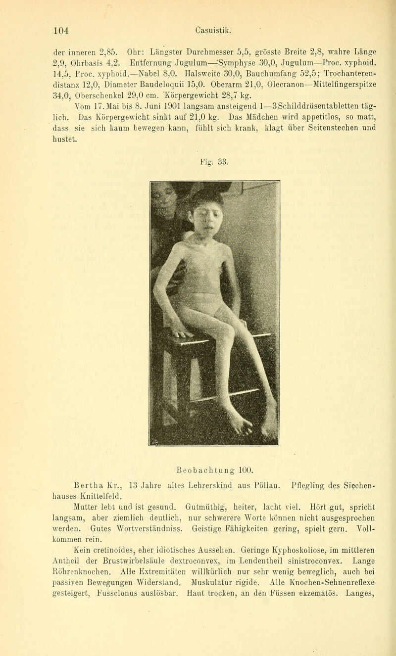 der inneren 2,85. Ohr: Längster Durchmesser 5,5, grösste Breite 2,8, wahre Länge 2,9, Ohrbasis 4,2. Entfernung Jugulum—-'Symphyse 30,0, Jugulum—Proc. xyphoid. 14,5, Proc. xj^phoid.—Nabel 8,0. Halsweite 30,0, Bauchumfang 52,5; Trochanteren- distanz 12,0, üiameter Baudeloquii 15,0. Oberarm 21,0, Olecranon—Mittelfingerspitze 34,0, Oberschenkel 29,0 cm. 'Körpergewicht 28,7 kg. Vom 17. Mai bis 8. .Juni 1901 laugsam ansteigend 1—3Schilddriisentabletten täg- lich. Das Körpergewicht sinkt auf 21,0 kg. Das Mädchen wird appetitlos, so matt, dass sie sich kaum bewegen kann, fühlt sich krank, klagt über Seitenstechen und hustet. Fig. 33. Beobachtung 100. Bertha Kr., 13 Jahre altes Lehrerskind aus Pöllau. Pflegling des Siechen- hauses Knittelfeld. Mutter lebt und ist gesund. Gutmüthig, heiter, lacht viel. Hört gut, spricht langsam, aber ziemlich deutlich, nur schwerere Worte können nicht ausgesprochen werden. Gutes Wortverständniss. Geistige Fähigkeiten gering, spielt gern. Voll- kommen rein. Kein cretinoides, eher idiotisches Aussehen. Geringe Kyphoskoliose, im mittleren Antheil der Brustwirbelsäule dextroconvex, im Lendentheil sinistroconvex. Lange Röhrenknochen. Alle Extremitäten willkürlich nur sehr wenig beweglich, auch bei passiven Bewegungen Widerstand. Muskulatur rigide. Alle Knochen-Sehnenreflexe gesteigert, Fussclonus auslösbar. Haut trocken, an den Füssen ekzematös. Langes,