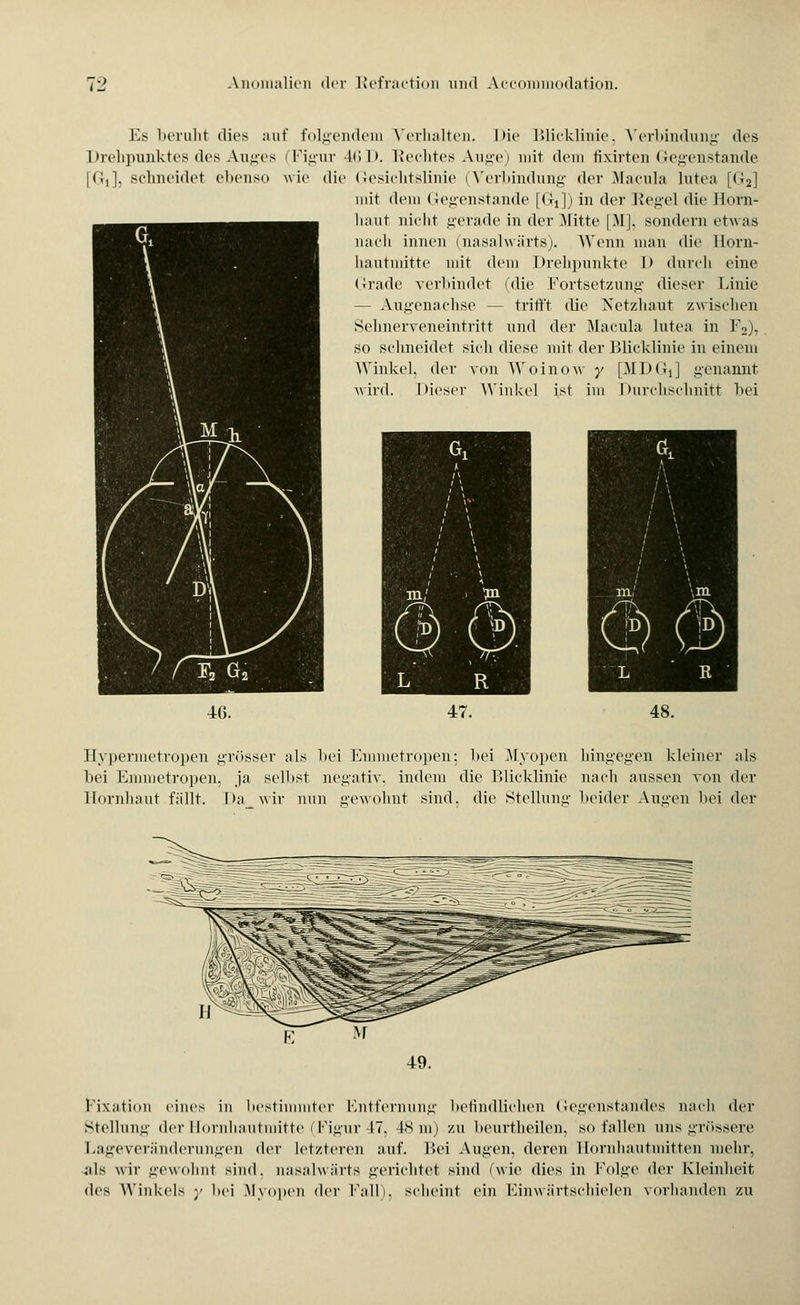 Es beruht dies auf folgendem Verhalten. l>ie Blicklinie. Verbindung des Drehpunktes des Auges (Figur 46D. Rechtes Auge) mit dem fixirten Gegenstande [Gi], schneidet ebenso wie die Gesichtslinie (Verbindung der Macula Inten [G2] mit dem Gegenstande [Gi]) in der Regel die Hörn* haut nicht gerade in der Mitte [MJ, sondern etwas nach innen (nasalwärts). Wenn man die Horn- hautmitte mit dem Drehpunkte I» durch eine Grade verbindet (die Fortsetzung dieser Linie - Augenachse — trifft die Netzhaut zwischen Sehnerveneintritt und der Macula lutea in F2). so sehneidet sich diese mit der Blicklinie in einem Winkel, der von Woinow y [MDGi] genannt -wird. Dieser Winkel ist im Durchschnitt hei Hypermetröpen grösser als hei Emmetropen; bei .Myopen hingegen kleiner als hei Emmetropen. ja seihst negativ, indem die Blicklinie nach aussen von der Hornhaut fällt. Da wir nun gewohnt sind, die Stellung heider Augen bei der Fixation eines in bestimmter Entfernung befindlichen Gegenstandes nach der Stellung der Hornhautmitte (Figur 47, 48 m) zu beurtheilen, so fallen uns grössere Lageveränderungen der letzteren auf. Bei Augen, deren Hornhautmitten mehr, ;ils wir gewohnt sind, nasalwärts gerichtet sind (wie dies in Folge der Kleinheit des Winkels ■■ bei Mvopen der Fall), scheint ein Kinw iirtschielen vorhanden zu