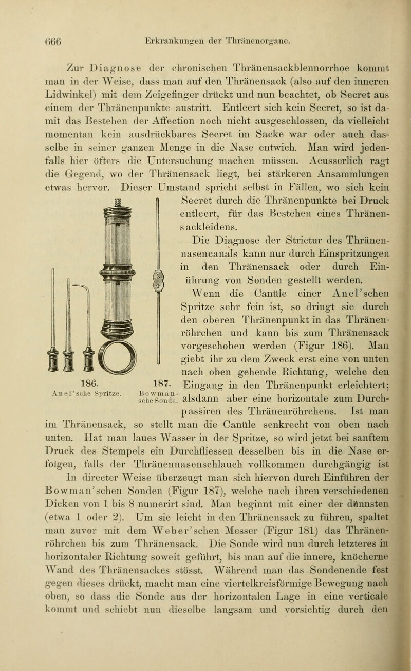 Zur Diagnose der chronischen Thränensackblennorrhoe kommt man in der Weise, dass man auf den Thränensack (also auf den inneren Lidwinkel i mit dem Zeigefinger drückt und nun beachtet, ob Seeret aus einem der Thranenpunkte austritt. Entleert sich kein Seeret, so ist da- mit das Bestehen der Affection noch nicht ausgeschlossen, da vielleicht momentan kein ausdrückbares Seeret im Sacke war oder auch das- selbe in seiner ganzen Menge in die Nase entwich. Man wird jeden- falls hier öfters die Untersuchung machen müssen. Aeusserlich ragt die Gegend, wo der Thränensack liegt, bei stärkeren Ansammlungen etwas hervor. Dieser Umstand spricht selbst in Fällen, wo sich kein I) Secret durch die Thranenpunkte bei Druck entleert, für das Bestehen eines Thränen- s ackleidens. Die Diagnose der Strictur des Thränen- nasencanals kann nur durch Einspritzungen in den Thränensack oder durch Ein- I ührung von Sonden gestellt werden. Wenn die Canüle einer Anel'sehen Spritze sehr fein ist, so dringt sie durch den oberen Thränenpunkt in das Thränen- röhrchen und kann bis zum Thränensack vorgeschoben werden (Figur 186). Man giebt ihr zu dem Zweck erst eine von unten nach oben gehende Richtung, welche den Eingang in den Thränenpunkt erleichtert; aber eine horizontale zum Durch- passiren des Thränenröhrchens. Ist man im Thränensack, so stellt man die Canüle senkrecht von oben nach unten. Hat man laues Wasser in der Spritze, so wird jetzt bei sanftem Druck des Stempels ein Durchmessen desselben bis in die Nase er- folgen, falls der Thränennasenschlauch vollkommen durchgängig ist In directer Weise überzeugt man sich hiervon durch Einführen der Bowman'sehen Sonden (Figur 187), welche nach ihren verschiedenen Dicken von 1 bis 8 numerirt sind. Man beginnt mit einer der dünnsten (etwa 1 oder 2). Um sie leicht in den Thränensack zu führen, spaltet man zuvor mit dem Weber'schen Messer (Figur 181) das Thränen- röhrchen bis zum Thränensack. Die Sonde wird nun durch letzteres in horizontaler Richtung soweit geführt, bis man auf die innere, knöcherne Wand des Thränensaekes stösst. Während man das Sondenende fest gegen dieses drückt, macht man eine viertelkreisfürmige Bewegung nach oben, so dass die Sonde aus der horizontalen Lage in eine verticale kommt und schiebt nun dieselbe langsam und vorsichtig durch den 186. Au el' sehe Spritze. 187. B o w in aii - scheSonde. alsdann