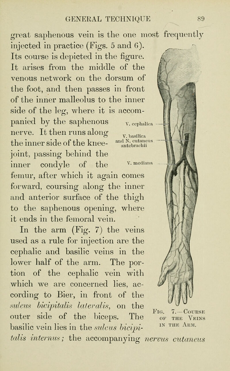 y, cephalica V. basilica and N. cutaneus antebrachii V. mediana '0^ great saphenous vein is the one most frequently injected in practice (Figs. 5 and 6). ^, Its course is depicted in the figure. / It arises from the middle of the / venous network on the dorsum of (' the foot, and then passes in front of the inner malleolus to the inner side of the leg, where it is accom- panied by the saphenous nerve. It then runs along the inner side of the knee- joint, passing behind the inner condyle of the femur, after which it again comes forward, coursing along the inner and anterior surface of the thigh to the saphenous opening, where it ends in the femoral vein. In the arm (Fig. 7) the veins used as a rule for injection are the cephalic and basilic veins in the lower half of the arm. The por- tion of the cephalic vein with which we are concerned lies, ac- cording to Bier, in front of the sulcus hicipitalis lateralis, on the outer side of the biceps. The basilic vein lies in the sulcus hicipi- talis internus; the accompanying nervus cutaneus u Fig. 7.—Course OF THE Veins IN THE Arm.