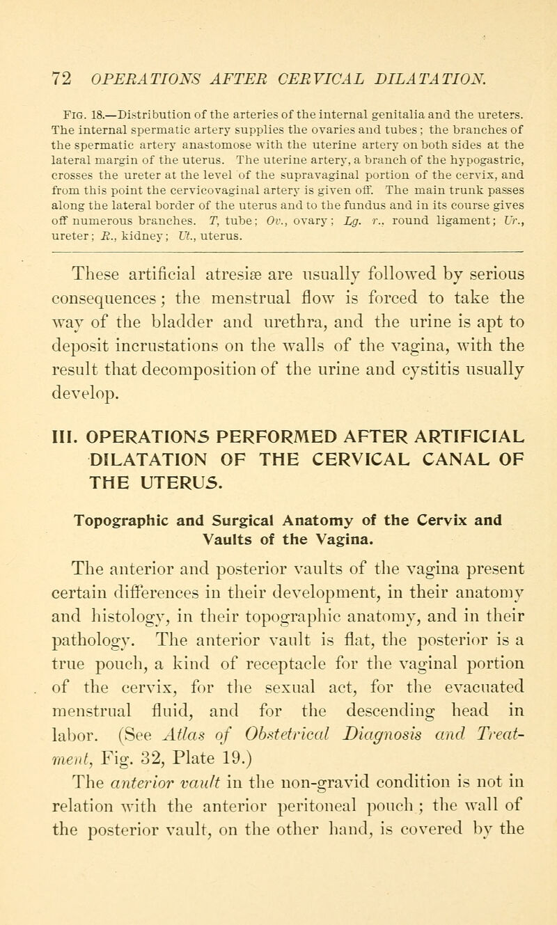 Fig. 18.—Distribution of the arteries of the internal genitalia and the ureters. The internal spermatic artery supplies the ovaries and tubes ; the branches of the spermatic artery anastomose with the uterine artery on both sides at the lateral margin of the uterus. The uterine artery, a branch of the hypogastric, crosses the ureter at the level of the supravaginal portion of the cervix, and from this point the cervicovaginal artery is given off. The main trunk passes along the lateral border of the uterus and to the fundus and in its course gives off numerous branches. T, tube; Or., ovary; Lg. r.. round ligament; Ur., ureter; E., kidney; UL, uterus. These artificial atresias are usually followed by serious consequences; the menstrual flow is forced to take the way of the bladder and urethra, and the urine is apt to deposit incrustations on the walls of the vagina, with the result that decomposition of the urine and cystitis usually develop. III. OPERATIONS PERFORMED AFTER ARTIFICIAL DILATATION OF THE CERVICAL CANAL OF THE UTERUS. Topographic and Surgical Anatomy of the Cervix and Vaults of the Vagina. The anterior and posterior vaults of the vagina present certain differences in their development, in their anatomy and histology, in their topographic anatomy, and in their pathology. The anterior vault is flat, the posterior is a true pouch, a kind of receptacle for the vaginal portion of the cervix, for the sexual act, for the evacuated menstrual fluid, and for the descending head in labor. (See Atlas of Obstetrical Diagnosis and Treat- ment, Fig. 32, Plate 19.) The anterior vault in the non-gravid condition is not in relation with the anterior peritoneal pouch ; the wall of the posterior vault, on the other hand, is covered by the