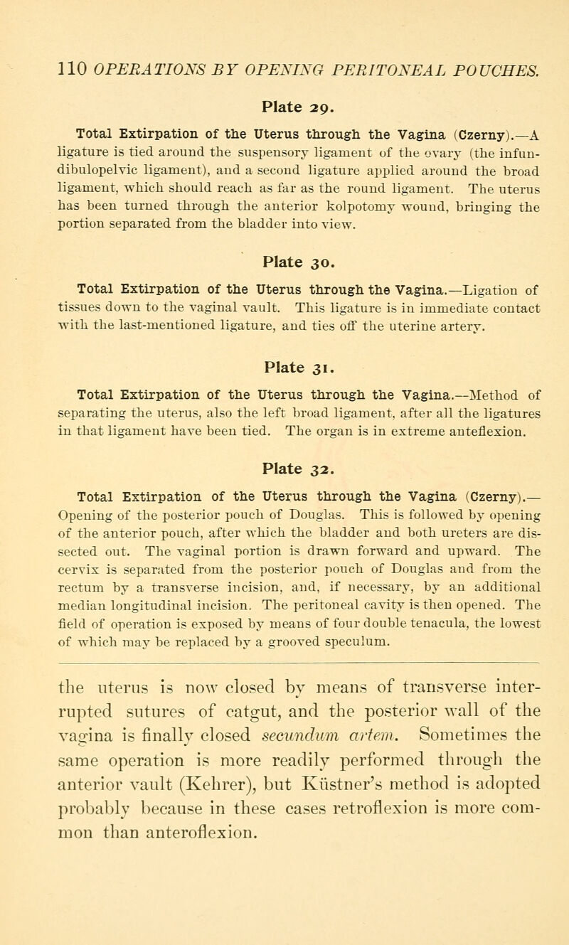Plate 29. Total Extirpation of the Uterus through the Vagina (Czerny).—A ligature is tied around the suspensory ligament of the ovary (the infun- dibulopelvic ligament), and a second ligature applied around the broad ligament, which should reach as far as the round ligament. The uterus has been turned through the anterior kolpotomy wound, bringing the portion separated from the bladder into view. Plate 30. Total Extirpation of the Uterus through the Vagina.—Ligation of tissues down to the vaginal vault. This ligature is in immediate contact with the last-mentioned ligature, and ties off the uterine arterv. Plate 31. Total Extirpation of the Uterus through the Vagina.—Method of separating the uterus, also the left broad ligament, after all the ligatures in that ligament have been tied. The organ is in extreme anteflexion. Plate 32. Total Extirpation of the Uterus through the Vagina (Czerny).— Opening of the posterior pouch of Douglas. This is followed by opening of the anterior pouch, after which the bladder and both ureters are dis- sected out. The vaginal portion is drawn forward and upward. The cervix is separated from the posterior pouch of Douglas and from the rectum by a transverse incision, and, if necessary, by an additional median longitudinal incision. The peritoneal cavity is then opened. The field of operation is exposed by means of four double tenacula, the lowest of which may be replaced by a grooved speculum. the uterus is now closed by means of transverse inter- rupted sutures of catgut, and the posterior wall of the vagina is finally closed secundum artem. Sometimes the same operation is more readily performed through the anterior vault (Kehrer), but Kustner's method is adopted probably because in these cases retroflexion is more com- mon than anteroflexion.