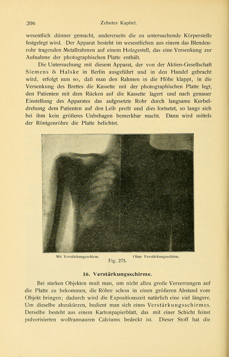 wesentlich dünner gemacht, andererseits die zu untersuchende Körperstelle festgelegt wird. Der Apparat besteht im wesentlichen aus einem das Blenden- rohr tragenden Metall rahmen auf einem Holzgestell, das eine Versenkung zur Aufnahme der photographischen Platte enthält. Die Untersuchung mit diesem Apparat, der von der Aktien-Gesellschaft Siemens & Halske in Berlin ausgeführt und in den Handel gebracht wird, erfolgt nun so, daß man den Rahmen in die Höhe klappt, in die Versenkung des Brettes die Kassette mit der photographischen Platte legt, den Patienten mit dem Rücken auf die Kassette lagert und nach genauer Einstellung des Apparates das aufgesetzte Rohr durch langsame Kurbel- drehung dem Patienten auf den Leib preßt und dies fortsetzt, so lange sich bei ihm kein größeres Unbehagen bemerkbar macht. Dann wird mittels der Röntgenröhre die Platte belichtet. Mit Vcrstärkungsschirm. FiP-. 275. Ohne Verstärkunsfsschirm. 16. Verstärkungsschirme. Bei starken Objekten muß man, um nicht allzu große Verzerrungen auf die Platte zu bekommen, die Röhre schon in einen größeren Abstand vom Objekt bringen; dadurch wird die Expositionszeit natürlich eine viel längere. Um dieselbe abzukürzen, bedient man sich eines Verstärkungsschirmes. Derselbe besteht aus einem Kartonpapierblatt, das mit einer Schicht feinst pulverisierten wolframsauren Calciums bedeckt ist. Dieser Stoff hat die