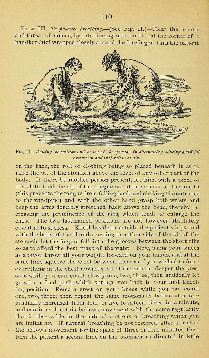 Rule III. To produce breathing.—(See Fig. II.)—Clear the mouth and throat of mucus, by introducing into the throat the corner of a handkerchief wrapped closely around the forefinger; turn the patient Fig. II. Shoiving the position and action of the operator-, in alternately producing a?-tijicial expiration and inspiration of air. on the back, the roll of clothing being so placed beneath it as to raise the pit of the stomach above the level of any other part of the body. If there be another person present, let him, with a piece of dry cloth, hold the tip of the tongue out of one corner of the mouth (this prevents the tongue from falling back and choking the entrance to the windpipe), and with the other hand grasp both wrists and keep the arms forcibly stretched back above the head, thereby in- creasing the prominence of the ribs, which tends to enlarge the chest. The two last-named positions are not, however, absolutely essential to success. Kneel beside or astride the patient's hips, and with the balls of the thumbs resting on either side of the pit of the stomach, let the fingers fall into the grooves between the short ribs so as to afford the best grasp of the waist. Now, using your knees as a pivot, throw all your weight forward on your hands, and at the same time squeeze the waist between them as if you wished to force everything in the chest upwards out of the mouth; deepen the pres- sure while you can count slowly one, two, three; then suddenly let go with a final push, which springs you back to your first kneel- ing position. Remain erect on your knees while you can count one, two, three; then repeat the same motions as before at a rate gradually increased from four or five to fifteen times in a minute, and continue thus this bellows movement with the same regularity that is observable in the natural motions of breathing which you are imitating. If natural breathing be not restored, after a trial of the bfellows movement for the space of three or four minutes, then turn the patient a second time on the stomach, as directed in Rule