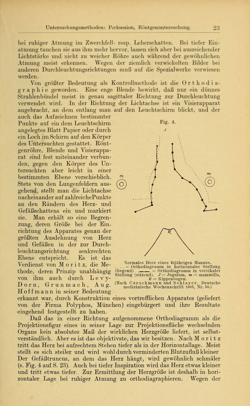 Untersucliungumothoden: Perkussion, Röntgenuntersuchung. -:; bei ruhiger Atmung im Zwerchfell- resp. Lebcrschatten. Hei tiefer Kin- atmung tauchen sie aus ihm mehr hervor, lassen sich aber bei ausreichender Lichtstärke und nicht zu weicher Röhre auch während der gewöhnlichen Atmung meist erkennen. Wegen der ziemlich verwickelten Bilder bei anderen Durchleuchtungsrichtungen muß auf die Spezialwerke verwiesen weiden. Von größter Bedeutung als Kontrollmethode ist die Orthodia- graphie geworden. Eine enge Blende bewirkt, daß nur ein dünnes Strahlenbündel meist in genau sagittaler Richtung zur Durchleuchtung verwendet wird. In der Richtung der Lichtachse ist ein Visierapparat angebracht, an dem entlang man auf den Leuchtschirm blickt, und der auch das Aufzeichnen bestimmter Punkte auf ein dem Leuchtschirm Fig. 4. angelegtes Blatt Papier oder durch j ein Loch im Schirm auf den Körper des Untersuchten gestattet. Rönt- genröhre, Blende und Visierappa- rat sind fest miteinander verbun- den, gegen den Körper des Un- tersuchten aber leicht in einer bestimmten Ebene verschieblich. Stets von den Lungenfeldern aus- (O gehend, stellt man die Lichtachse nacheinander auf zahlreichePunkte an den Rändern des Herz- und Gefäßschattens ein und markiert sie. Man erhält so eine Begren- zung, deren Größe bei der Ein- richtung des Apparates genau der größten Ausdehnung von Herz und Gefäßen in der zur Durch- leuchtungsrichtung senkrechten Ebene entspricht. Es ist das Vprrh'pnqf vnn Mnrit? rlip Mp- Normales Herz eines 22jährigen Mannes. V eraiensr von IVl O r 1 r Z, die IVie- = Orthodiagramm in horizontaler Stellung thode, deren Prinzip unabhängig (Hegend) . . = Orthodiagramm in vertikaler ., i -i i t Stellung (sitzend). J= Jugulum, m = mammilla, von ihm auch durch Levy- r = Rippenbogen. Dorn Crnnmarh Ann- (Nach Curschmann und Schlayer, Deutsche medizinische Wochenschrift 1905, Nr. 50.) Aug. Hoffmann in seiner Bedeutung erkannt war, durch Konstruktion eines vortrefflichen Apparates (geliefert von der Firma Polyphos, München) eingebürgert und ihre Resultate eingehend festgestellt zu haben. Daß das in einer Richtung aufgenommene Orthodiagramm als die Projektionsfigur eines in seiner Lage zur Projektionsfläche wechselnden Organs kein absolutes Maß der wirklichen Herzgröße liefert, ist selbst- verständlich. Aber es ist das objektivste, das wir besitzen. Nach Moritz tritt das Herz bei aufrechtem Stehen tiefer als in der Horizontallage. Meist stellt es sich steiler und wird wohl durch verminderten Blutzufluß kleiner Der Gefäßtruncus, an dem das Herz hängt, wird gewöhnlich schmäler (s. Fig. 4 auf S. 23). Auch bei tiefer Inspiration wird das Herz etwas kleiner und tritt etwas tiefer. Zur Ermittlung der Herzgröße ist deshalb in hori- zontaler Lage bei ruhiger Atmung zu orthodiagraphieren. Wegen der