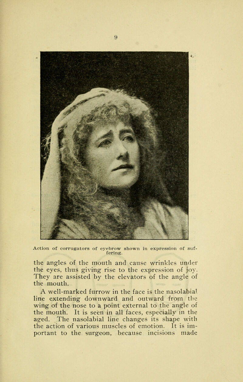 Action of corrugators of eyebrow shown hi expression of suf- fering. the angles of the mouth and cause wrinkles under the eyes, thus giving rise to the expression of joy. They are assisted by the elevators of the angle of the mouth. A well-marked furrow in the face is the nasolabial line extending downward and outward from the wing of the nose to a point external to the angle of the mouth. It is seen in all faces, especially in the aged. The nasolabial line changes its shape with the action of various muscles of emotion. It is im- portant to the surgeon, because incisions made