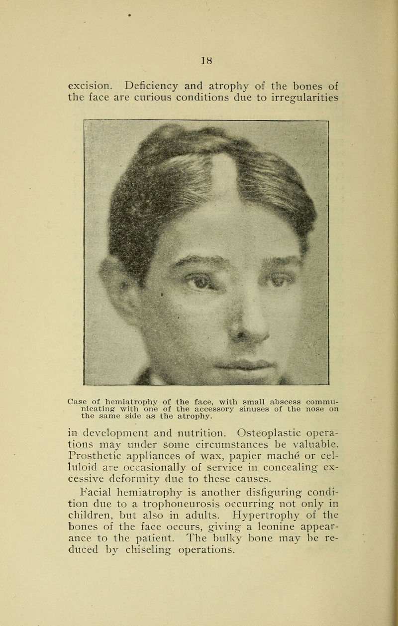 excision. Deficiency and atrophy of the bones of the face are curious conditions due to irregularities ^ p^^^fe^ 1 1 SRii^^^Wi M ;:,M*s m^rn Mm K 1 ''% 9 ^ m^ «f ». M. ,.,.»4i~^. k-,m,^ , ,»;,:,i.?^.*;^^ ^AFi- ^»»a ■ „,;i^ Case of hemiatrophy of the face, with small abscess com.mu- nicating with one of the accessory sinuses of the nose on the same side as the atrophy. in development and nutrition. Osteoplastic opera- tions may under some circumstances be valuable. Prosthetic appliances of wax, papier mache or cel- luloid are occasionally of service in concealing ex- cessive deformity due to these causes. Facial hemiatrophy is another disfiguring condi- tion due to a trophoneurosis occurring not only in children, but also in adults. Hypertrophy of the bones of the face occurs, giving a leonine appear- ance to the patient. The bulky bone may be re- duced by chiseling operations.