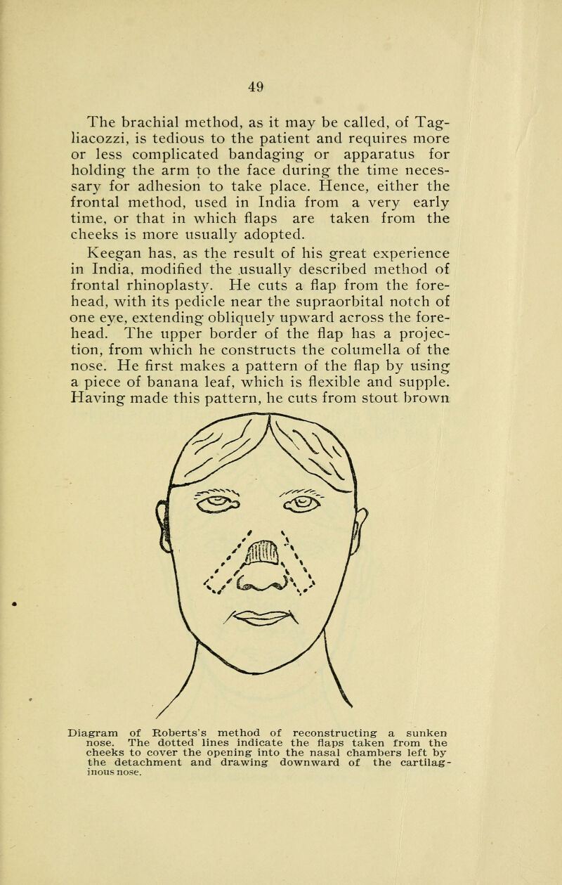 The brachial method, as it may be called, of Tag- liacozzi, is tedious to the patient and requires more or less complicated bandaging or apparatus for holding the arm to the face during the time neces- sary for adhesion to take place. Hence, either the frontal method, used in India from a very early time, or that in which flaps are taken from the cheeks is more usually adopted. Keegan has, as the result of his great experience in India, modified the .usually described method of frontal rhinoplasty. He cuts a flap from the fore- head, with its pedicle near the supraorbital notch of one eye, extending obliquely upward across the fore- head. The upper border of the flap has a projec- tion, from which he constructs the columella of the nose. He first makes a pattern of the flap by using a piece of banana leaf, which is flexible and supple. Having made this pattern, he cuts from stout brown Diagram of Roberts's method of reconstructing a sunken nose. The dotted lines indicate the flaps taken from the cheeks to cover the opening into the nasal chambers left by the detachment and drawing downward of the cartilag- inous nose.