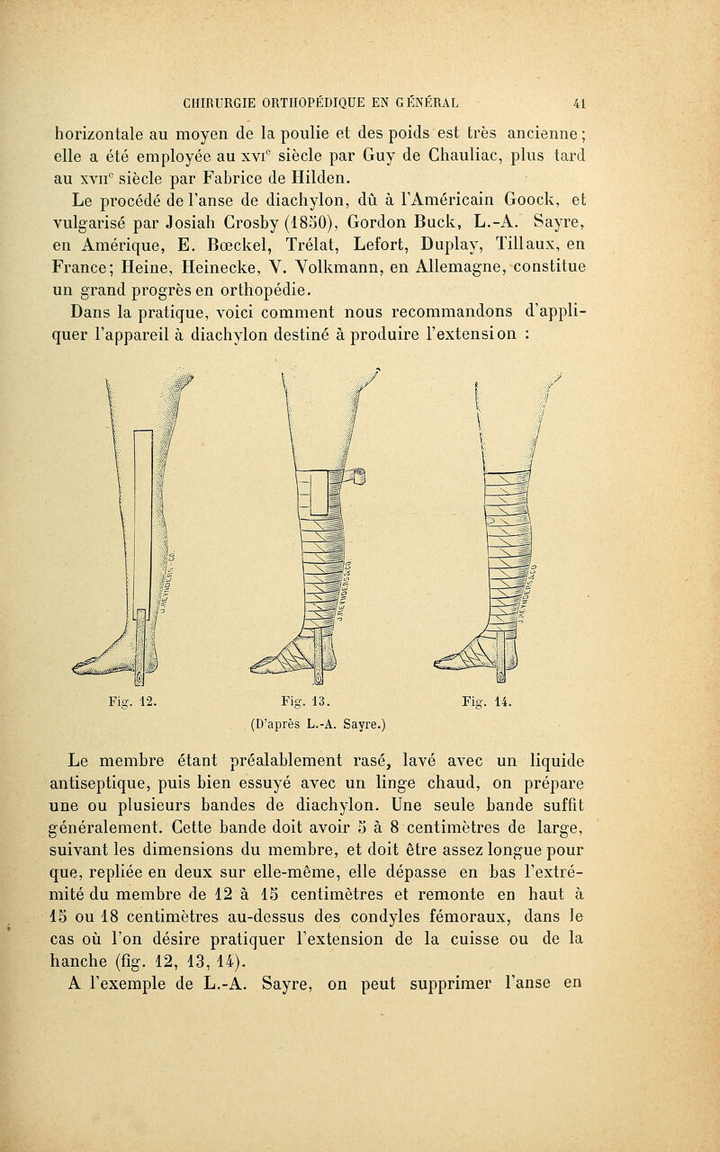 horizontale au moyen de la poulie et des poids est très ancienne ; elle a été employée au xvi° siècle par Guy de Chauliac, plus tard au xvn'^ siècle par Fabrice de Hilden. Le procédé de l'anse de diachylon, dû à l'Américain Goock, et vulgarisé par Josiah Crosby (1830), Gordon Buck, L.-A. Sayre, en Amérique, E. Bœckel, Trélat, Lefort, Duplay, Tillaux, en France; Heine, Heinecke, V. Yolkmann, en Allemagne, constitue un grand progrès en orthopédie. Dans la pratique, voici comment nous recommandons d'appli- quer l'appareil à diachylon destiné à produire l'extension : Fio-. 12. Fig. 13. (D'après L.-A. Sayre. Fiû-. 14. Le membre étant préalablement rasé, lavé avec un liquide antiseptique, puis bien essuyé avec un linge chaud, on prépare une ou plusieurs bandes de diachylon. Une seule bande suffit généralement. Cette bande doit avoir S à 8 centimètres de large, suivant les dimensions du membre, et doit être assez longue pour que, repliée en deux sur elle-même, elle dépasse en bas l'extré- mité du membre de 12 à 15 centimètres et remonte en haut à 15 ou 18 centimètres au-dessus des condyles fémoraux, dans le cas où l'on désire pratiquer l'extension de la cuisse ou de la hanche (fig. 12, 13, 14). A l'exemple de L.-A. Sayre, on peut supprimer l'anse en