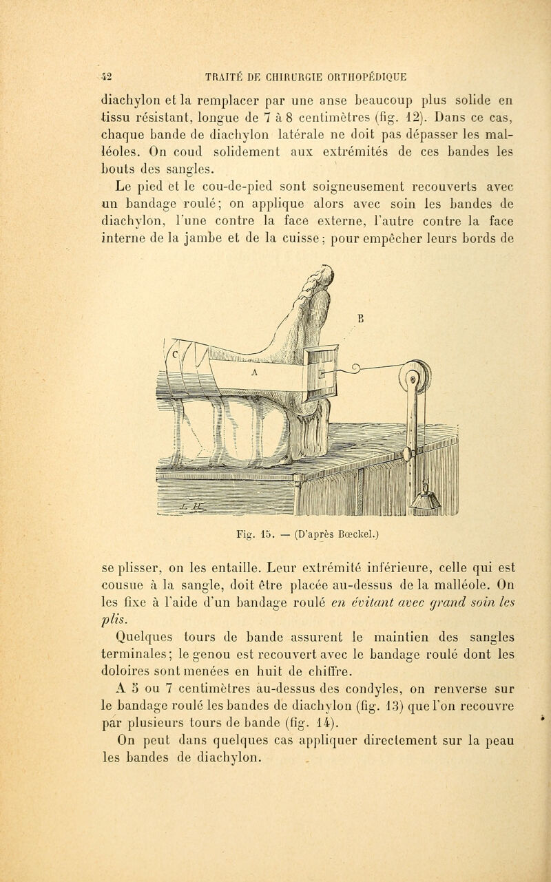diachylon et la remplacer par une anse beaucoup plus solide en tissu résistant, longue de 7 à 8 centimètres (fig. 12). Dans ce cas, chaque bande de diachylon latérale ne doit pas dépasser les mal- léoles. On coud solidement aux extrémités de ces bandes les bouts des sangles. Le pied et le cou-de-pied sont soigneusement recouverts avec un bandage roulé; on applique alors avec soin les bandes de diachylon, Tune contre la face externe, l'autre contre la face interne de la jambe et de la cuisse ; pour empêcher leurs bords de Fig. 15. — (D'après Bœckel.) se plisser, on les entaille. Leur extrémité inférieure, celle qui est cousue à la sangle, doit être placée au-dessus de la malléole. On les fixe à Faide d'un bandage roulé en évitant avec grand soin les plis. Quelques tours de bande assurent le maintien des sangles terminales ; le genou est recouvert avec le bandage roulé dont les doloires sont menées en huit de chiffre. A S ou 7 centimètres au-dessus des condyles, on renverse sur le bandage roulé les bandes de diachylon (fig. 13) que Ton recouvre par plusieurs tours de bande (fig. 14). On peut dans quelques cas appliquer directement sur la peau les bandes de diachylon.