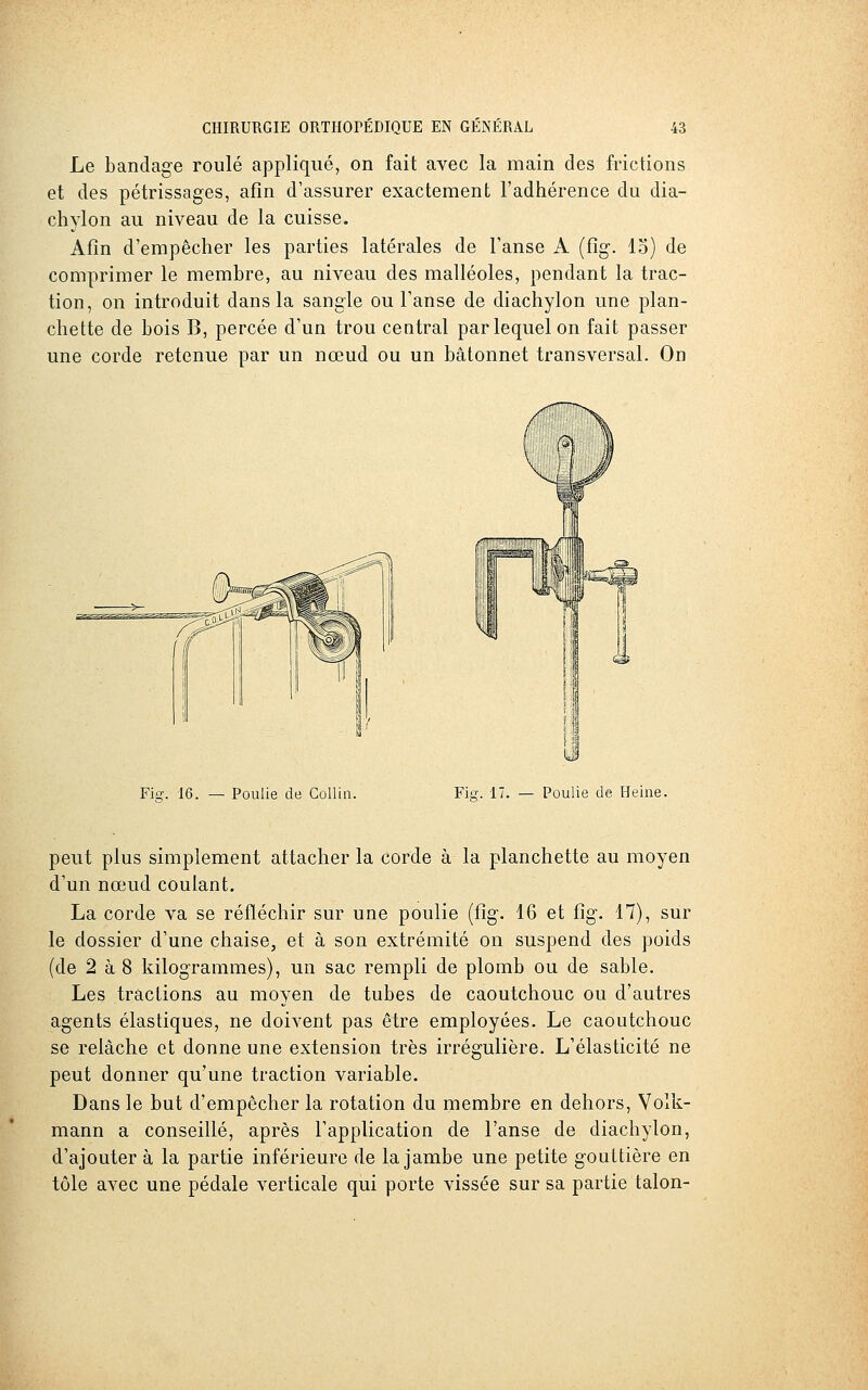Le bandage roulé appliqué, on fait avec la main des frictions et des pétrissages, afin d'assurer exactement l'adhérence du dia- chylon au niveau de la cuisse. Afin d'empêcher les parties latérales de l'anse A (fig. 15) de comprimer le membre, au niveau des malléoles, pendant la trac- tion, on introduit dans la sangle ou l'anse de diachylon une plan- chette de bois B, percée d'un trou central par lequel on fait passer une corde retenue par un nœud ou un bâtonnet transversal. On Fi^. 16. — Poulie de Collin. Fie-. 17. — Poulie de Heine. peut plus simplement attacher la corde à la planchette au moyen d'un nœud coulant. La corde va se réfléchir sur une poulie (fig. 16 et fig. 17), sur le dossier d'une chaise, et à son extrémité on suspend des poids (de 2 à 8 kilogrammes), un sac rempli de plomb ou de sable. Les traction.s au moyen de tubes de caoutchouc ou d'autres agents élastiques, ne doivent pas être employées. Le caoutchouc se relâche et donne une extension très irrégulière. L'élasticité ne peut donner qu'une traction variable. Dans le but d'empêcher la rotation du membre en dehors, Volk- mann a conseillé, après l'application de l'anse de diachylon, d'ajouter à la partie inférieure de la jambe une petite gouttière en tôle avec une pédale verticale qui porte vissée sur sa partie talon-