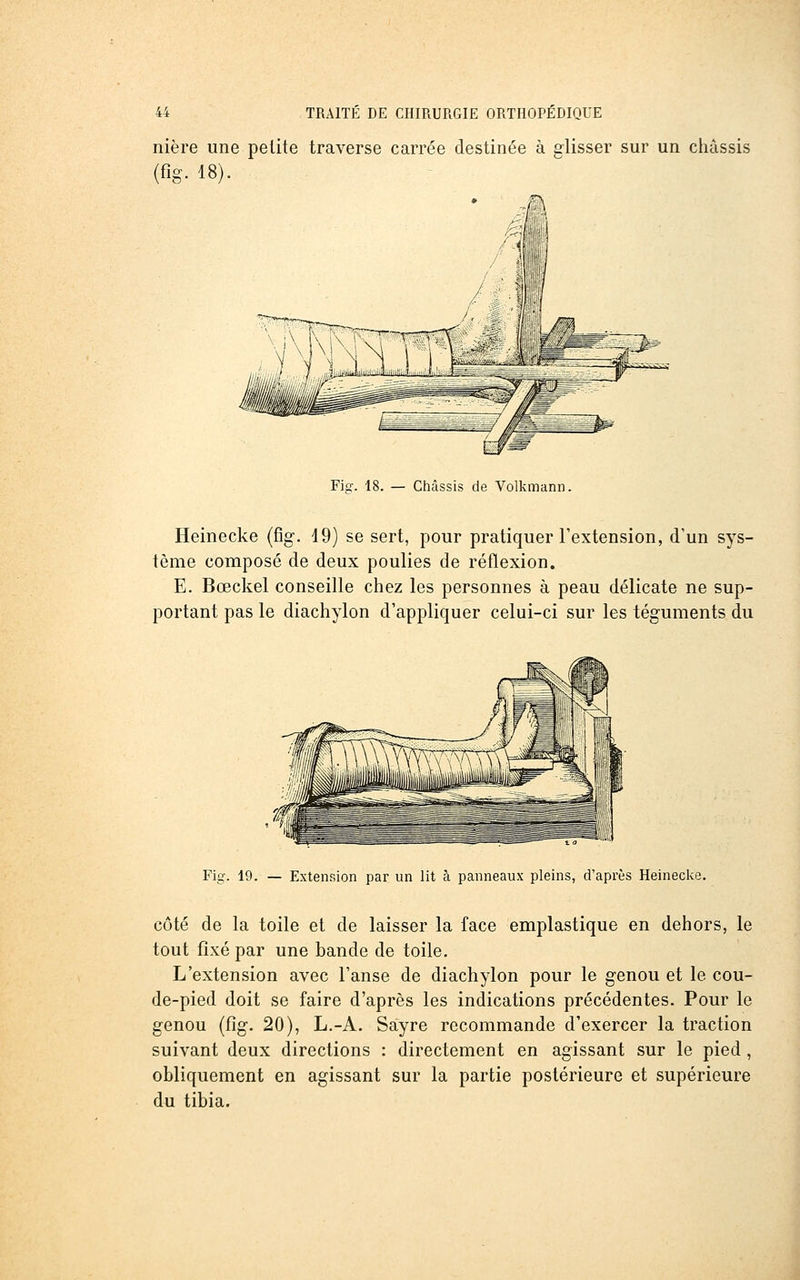 nière une petite traverse carrée destinée à glisser sur un châssis (fig. 18). Fi-. 18. — Châssis de Volkmann. Heinecke (%. 49) se sert, pour pratiquer l'extension, d'un sys- tème composé de deux poulies de réflexion. E. Bœckel conseille chez les personnes à peau délicate ne sup- portant pas le diachylon d'appliquer celui-ci sur les téguments du Fig. 19. — Extension par un lit à panneaux pleins, d'après Heinecke. côté de la toile et de laisser la face emplastique en dehors, le tout fixé par une bande de toile. L'extension avec l'anse de diachylon pour le genou et le cou- de-pied doit se faire d'après les indications précédentes. Pour le genou (fig. 20), L.-A. Sayre recommande d'exercer la traction suivant deux directions : directement en agissant sur le pied, obliquement en agissant sur la partie postérieure et supérieure du tibia.