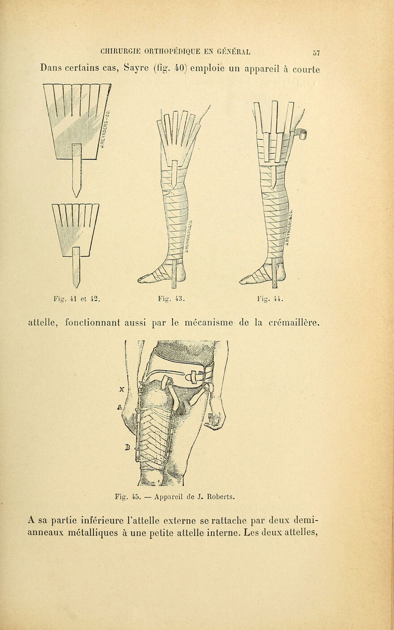 Dans certains cas, Sayre (fig-. 40) emploie un appareil à courte Fi-. 44. Fig. 41 et 42. attelle, fonctionnant aussi par le mécanisme de la crémaillère. Fig. 45. — Appareil de J. Roberts. A sa partie inférieure l'attelle externe se rattache par deux demi- anneaux métalliques à une petite attelle interne. Les deux attelles,