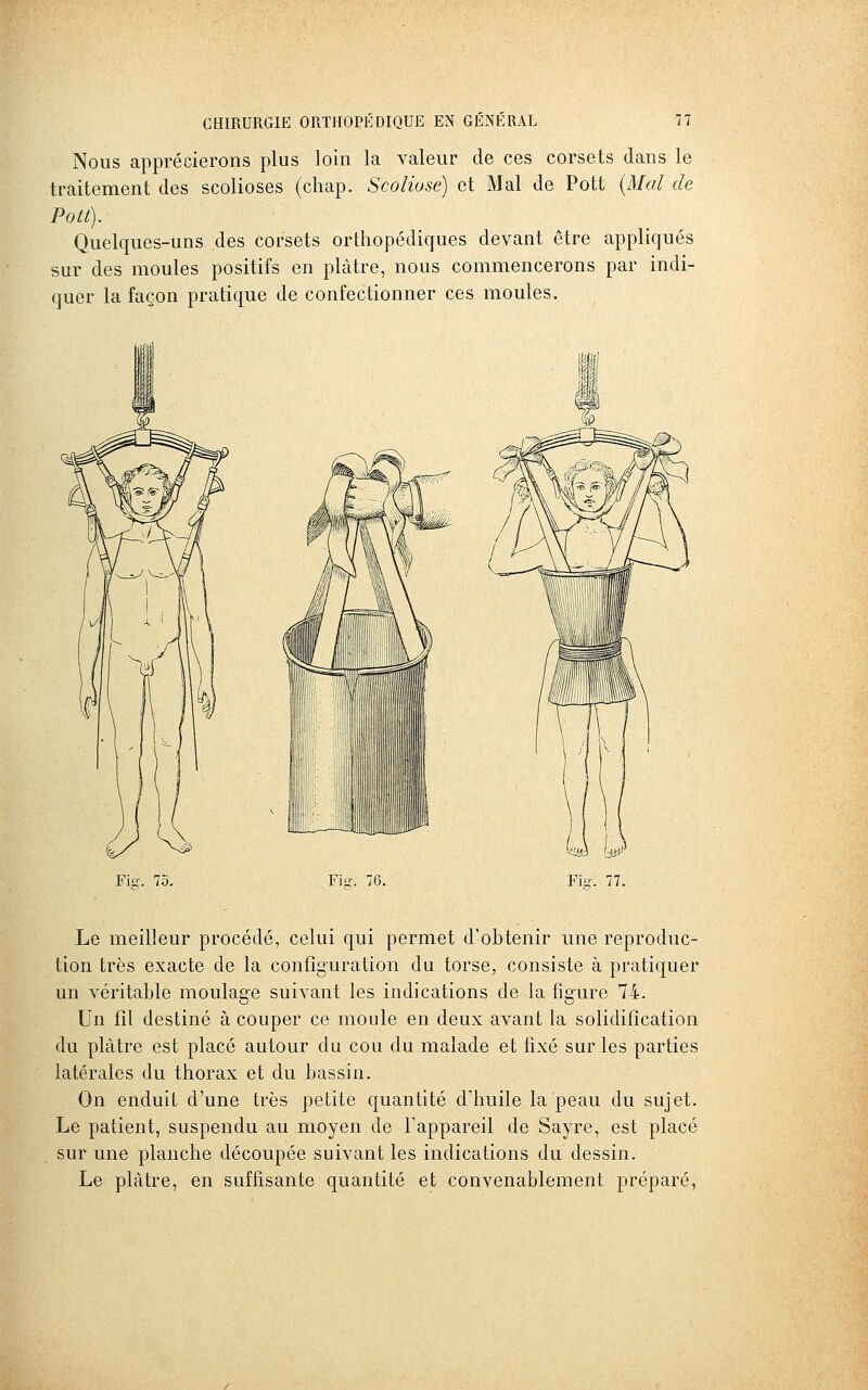 Nous apprécierons plus loin la valeur de ces corsets dans le traitement des scolioses (chap. Scoliose) et Mal de Pott {Mal de Pou). Quelques-uns des corsets orthopédiques devant être appliqués sur des moules positifs en plâtre, nous commencerons par indi- quer la façon pratique de confectionner ces moules. Fis-. 75. Fio-. 76 Le meilleur procédé, celui qui permet d'obtenir une reproduc- tion très exacte de la configuration du torse, consiste à pratiquer un véritable moulage suivant les indications de la figure 74. Un fil destiné à couper ce moule en deux avant la solidification du plâtre est placé autour du cou du malade et fixé sur les parties latérales du thorax et du bassin. On enduit d'une très petite quantité d'huile la peau du sujet. Le patient, suspendu au moyen de l'appareil de Sayre, est placé sur une planche découpée suivant les indications du dessin. Le plâtre, en suffisante quantité et convenablement préparé,