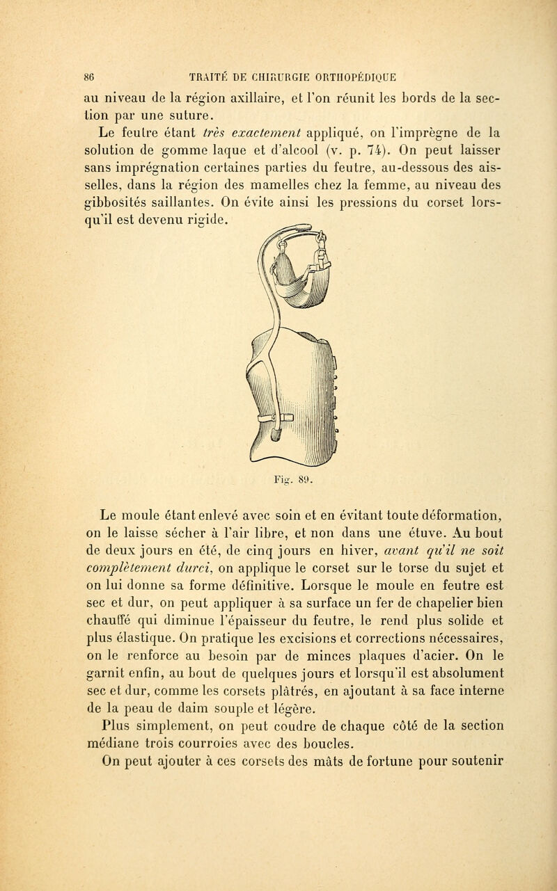 au niveau de la région axiliaire, et l'on réunit les bords de la sec- lion par une suture. Le feutre étant très exactement appliqué, on l'imprègne de la solution de gomme laque et d'alcool (v. p. 74). On peut laisser sans imprégnation certaines parties du feutre, au-dessous des ais- selles, dans la région des mamelles chez la femme, au niveau des gibbosités saillantes. On évite ainsi les pressions du corset lors- qu'il est devenu rigide. Y\». 89. Le moule étant enlevé avec soin et en évitant toute déformation, on le laisse sécher à l'air libre, et non dans une étuve. Au bout de deux jours en été, de cinq jours en hiver, avant quil ne soit complètement durci, on applique le corset sur le torse du sujet et on lui donne sa forme définitive. Lorsque le moule en feutre est sec et dur, on peut appliquer à sa surface un fer de chapelier bien chauffé qui diminue l'épaisseur du feutre, le rend plus solide et plus élastique. On pratique les excisions et corrections nécessaires, on le renforce au besoin par de minces plaques d'acier. On le garnit enfin, au bout de quelques jours et lorsqu'il est absolument sec et dur, comme les corsets plâtrés, en ajoutant à sa face interne de la peau de daim souple et légère. Plus simplement, on peut coudre de chaque côté de la section médiane trois courroies avec des boucles. On peut ajouter à ces corsets des mâts de fortune pour soutenir