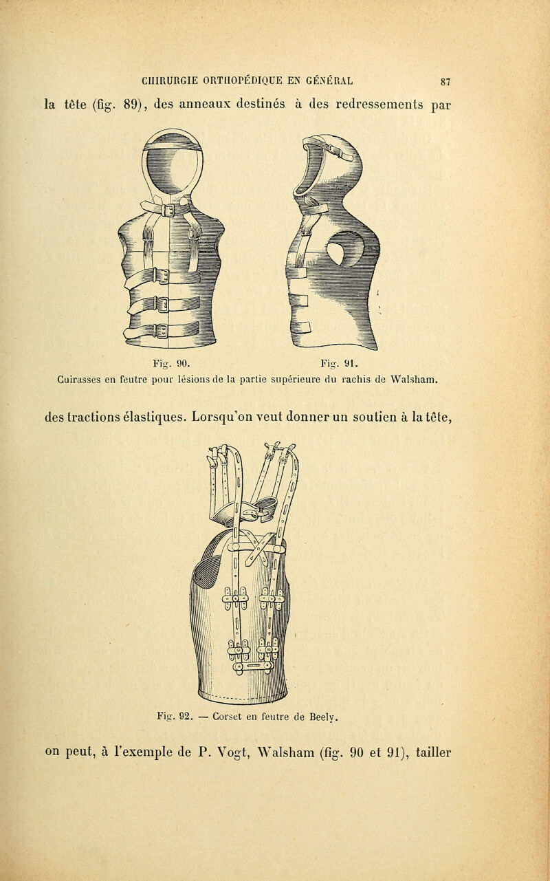 la tête (fig. 89), des anneaux destinés à des redressements par Fig. 90. Fig. 91. Cuirasses en feutre pour lésions de la partie supérieure du rachis de Walsham. des tractions élastiques. Lorsqu'on veut donner un soutien à la tête, Fig. 92. — Corset en feutre de Beely. on peut, à l'exemple de P. Vogt, Walsham (fig. 90 et 91), tailler