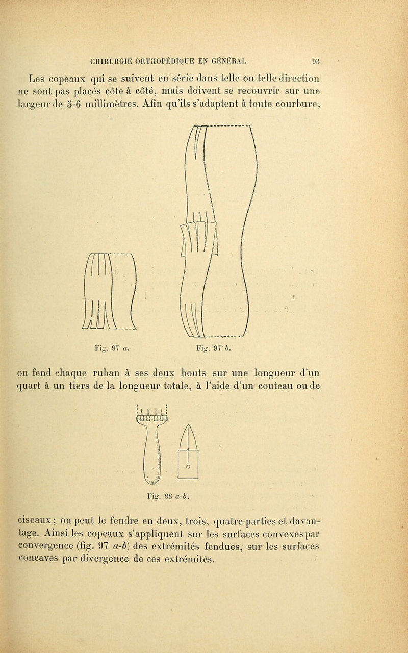 Les copeaux qui se suivent en série dans telle ou telle direction ne sont pas placés côte à côté, mais doivent se recouvrir sur une largeur de 5-6 millimètres. Afin qu'ils s'adaptent à toute courbure, Fi-. 97 a. Fiq-. 97 b. on fend chaque ruban à ses deux bouts sur une longueur d'un quart à un tiers de la longueur totale, à l'aide d'un couteau ou de Fio-. 98 a-b. ciseaux; on peut le fendre en deux, trois, quatre parties et davan- tage. Ainsi les copeaux s'appliquent sur les surfaces convexes par convergence (fîg. 97 a-b) des extrémités fendues, sur les surfaces concaves par divergence de ces extrémités.