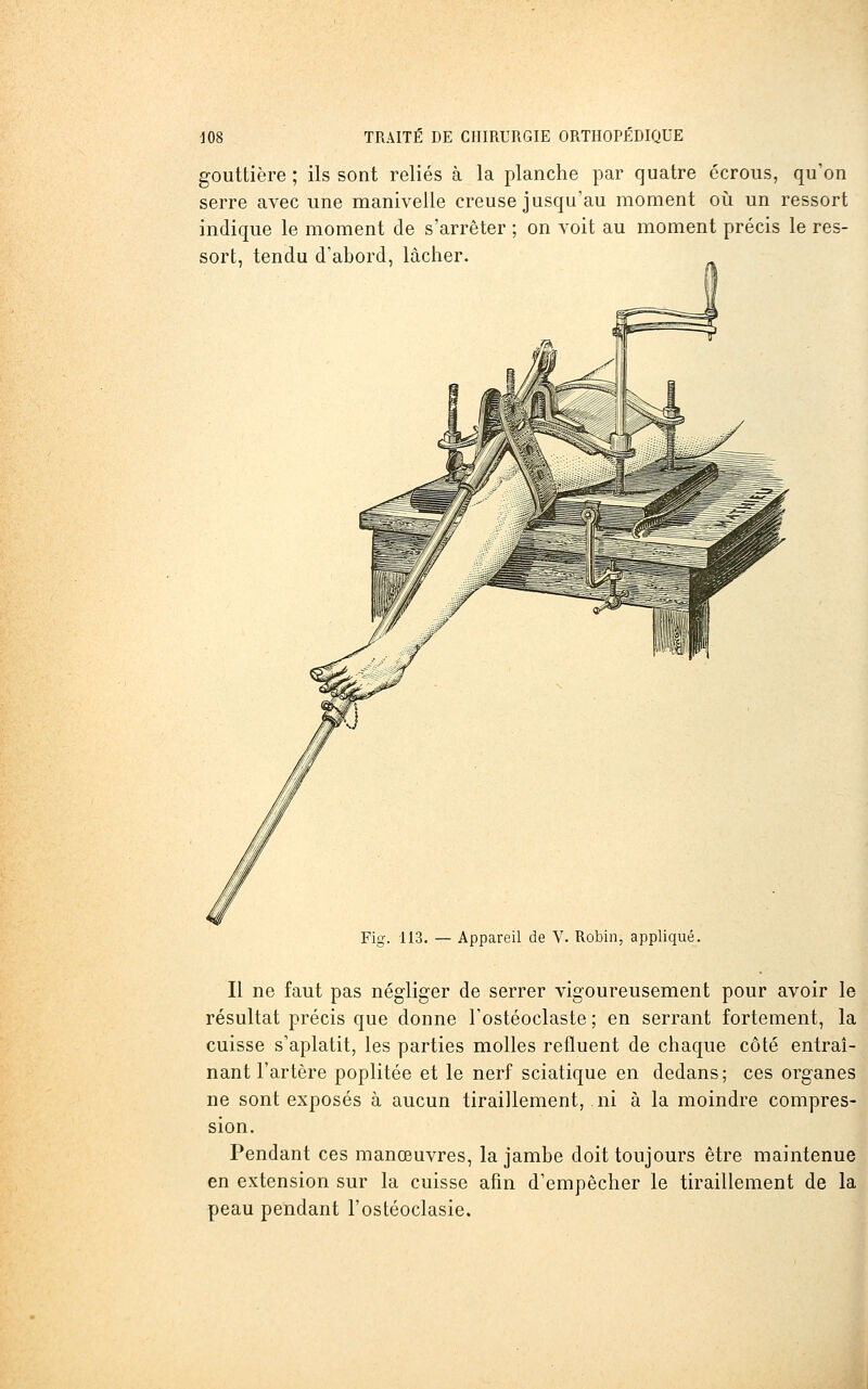 gouttière ; ils sont reliés à la planche par quatre écrous, qu'on serre avec une manivelle creuse jusqu'au moment où un ressort indique le moment de s'arrêter ; on voit au moment précis le res- sort, tendu d'abord, lâcher. Fig. 113. — Appareil de V. Robin, appliqué. Il ne faut pas négliger de serrer vigoureusement pour avoir le résultat précis que donne Tostéoclaste ; en serrant fortement, la cuisse s'aplatit, les parties molles refluent de chaque côté entraî- nant l'artère poplitée et le nerf sciatique en dedans; ces organes ne sont exposés à aucun tiraillement, ni à la moindre compres- sion. Pendant ces manœuvres, la jambe doit toujours être maintenue en extension sur la cuisse afin d'empêcher le tiraillement de la peau pendant l'ostéoclasie.