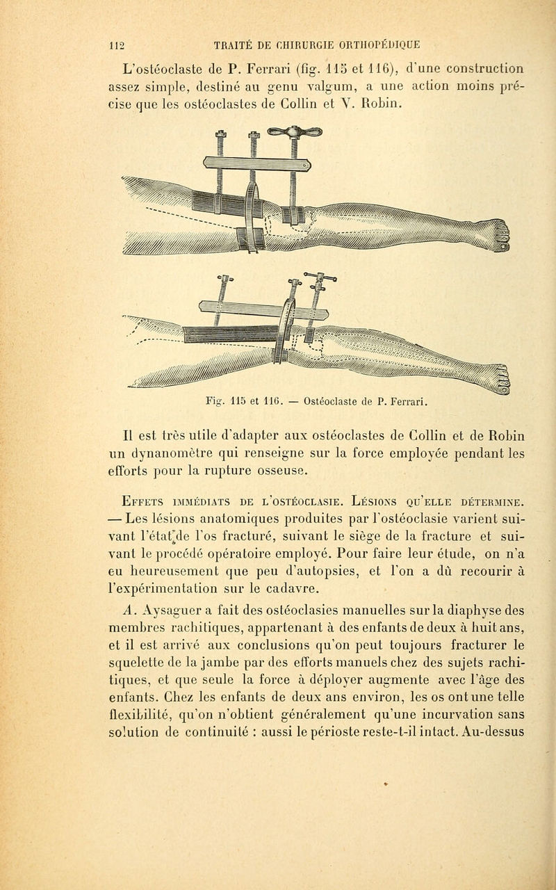 L'ostéoclaste de P. Ferrari (fig. 115 et 116), d'une construction assez simple, destiné au genu valgum, a une action moins pré- cise que les ostéoclastes de Collin et Y. Robin. Fig. 115 et 116. — Ostéoclaste de P. Ferrari. Il est très utile d'adapter aux ostéoclastes de Collin et de Robin un dynanomètre qui renseigne sur la force employée pendant les efforts pour la rupture osseuse. Effets immédiats de l'ostéoclaste. Lésions qu'elle détermine. — Les lésions anatomiques produites par Fostéoclasie varient sui- vant l'état^de l'os fracturé, suivant le siège de la fracture et sui- vant le procédé opératoire employé. Pour faire leur étude, on n'a eu heureusement que peu d'autopsies, et l'on a dû recourir à l'expérimentation sur le cadavre. A. Aysaguer a fait des ostéoclasies manuelles sur la diaphyse des membres rachitiques, appartenant à des enfants de deux à huit ans, et il est arrivé aux conclusions qu'on peut toujours fracturer le squelette de la jambe par des efforts manuels chez des sujets rachi- tiques, et que seule la force à déployer augmente avec l'âge des enfants. Chez les enfants de deux ans environ, les os ont une telle flexibilité, qu'on n'obtient généralement qu'une incurvation sans solution de continuité: aussi le périoste reste-t-il intact. Au-dessus