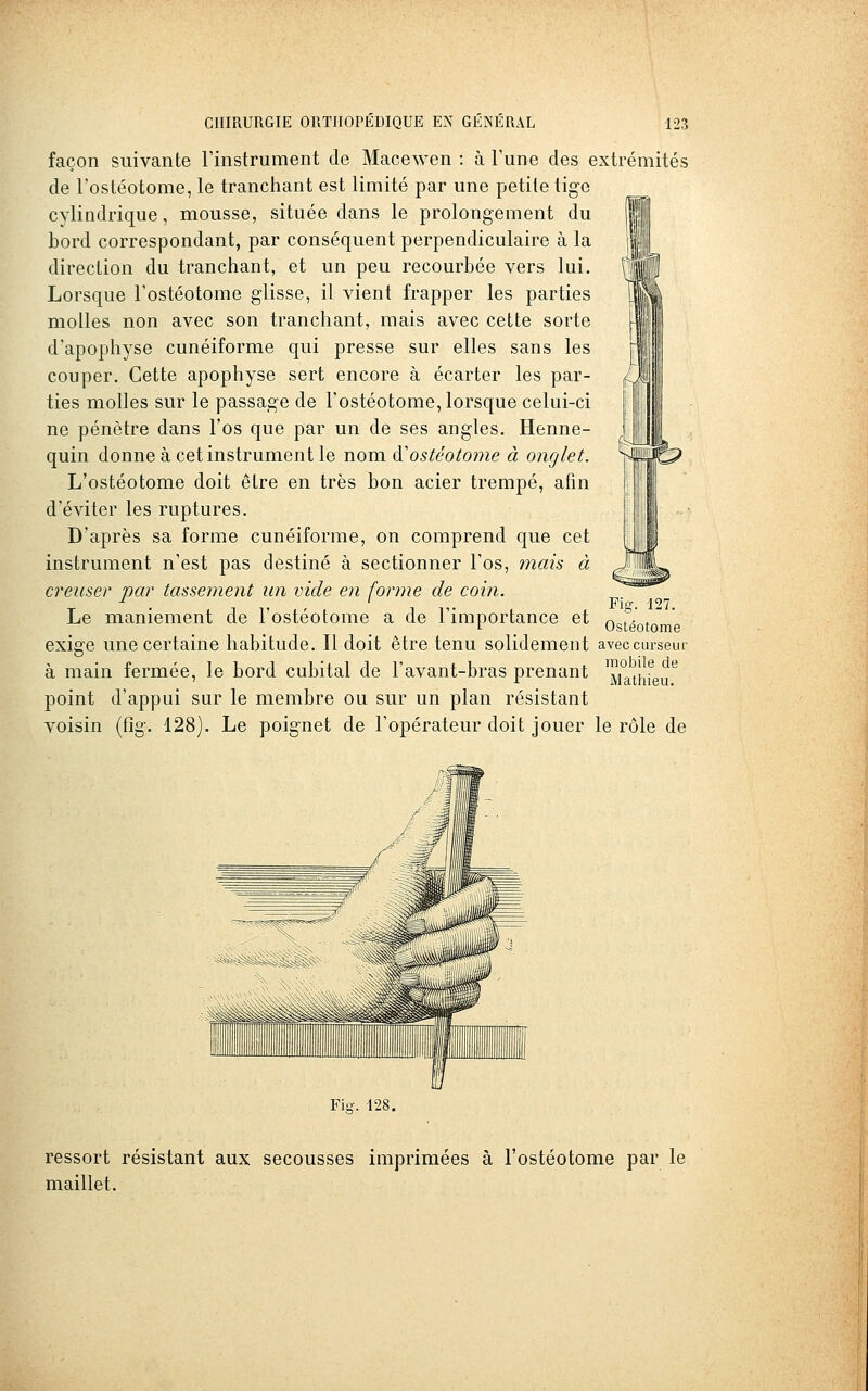 façon suivante l'instrument de Macewen : à l'une des extrémités de l'ostéotome, le tranchant est limité par une petite tige cylindrique, mousse, située dans le prolongement du bord correspondant, par conséquent perpendiculaire à la direction du tranchant, et un peu recourbée vers lui. Lorsque l'ostéotome glisse, il vient frapper les parties molles non avec son tranchant, mais avec cette sorte d'apophyse cunéiforme qui presse sur elles sans les couper. Cette apophyse sert encore à écarter les par- ties molles sur le passage de l'ostéotome, lorsque celui-ci ne pénètre dans l'os que par un de ses angles. Henne- quin donne à cet instrument le nom (ïosiéoto?7ie à onglet. L'ostéotome doit être en très bon acier trempé, afin d'éviter les ruptures. D'après sa forme cunéiforme, on comprend que cet instrument n'est pas destiné à sectionner l'os, mais à creuser par tassement un vide en forme de coin. . , ,. Fig. 127. Le maniement de l'ostéotome a de l'importance et ostéoto exige une certaine habitude. Il doit être tenu solidement aveccurseur à main fermée, le bord cubital de l'avant-bras prenant ™j'^athieu'^ point d'appui sur le membre ou sur un plan résistant voisin (fig. 128). Le poignet de l'opérateur doit jouer le rôle de Fio-. 128, ressort résistant aux secousses imprimées à l'ostéotome par le maillet.