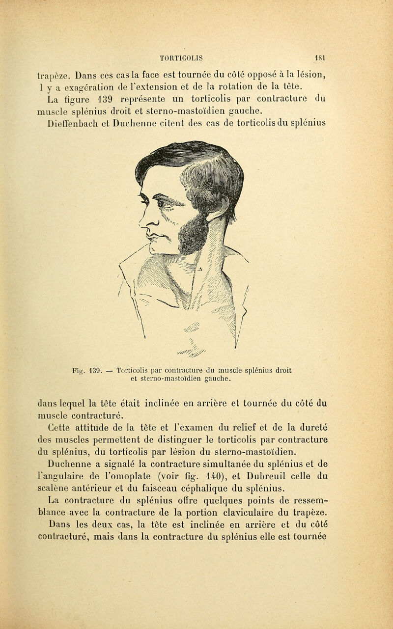trapèze. Dans ces cas la face est tournée du côté opposé à la lésion, 1 V a exagération de l'extension et de la rotation de la tête. La figure 139 représente un torticolis par contracture du muscle splénius droit et sterno-mastoïdien gauche. DiefTenbach et Duchenne citent des cas de torticolis du splénius Fig. 139. — Torticolis par contracture du muscle splénius droit et sterno-mastoïdien syauche. dans lequel la tête était inclinée en arrière et tournée du côté du muscle contracture. Cette attitude de la tête et l'examen du relief et de la dureté des muscles permettent de distinguer le torticolis par contracture du splénius, du torticolis par lésion du sterno-mastoïdien. Duchenne a signalé la contracture simultanée du splénius et de l'angulaire de l'omoplate (voir fig. 140), et Dubreuil celle du scalène antérieur et du faisceau céphalique du splénius, La contracture du splénius offre quelques points de ressem- blance avec la contracture de la portion claviculaire du trapèze. Dans les deux cas, la tête est inclinée en arrière et du côté contracture, mais dans la contracture du splénius elle est tournée